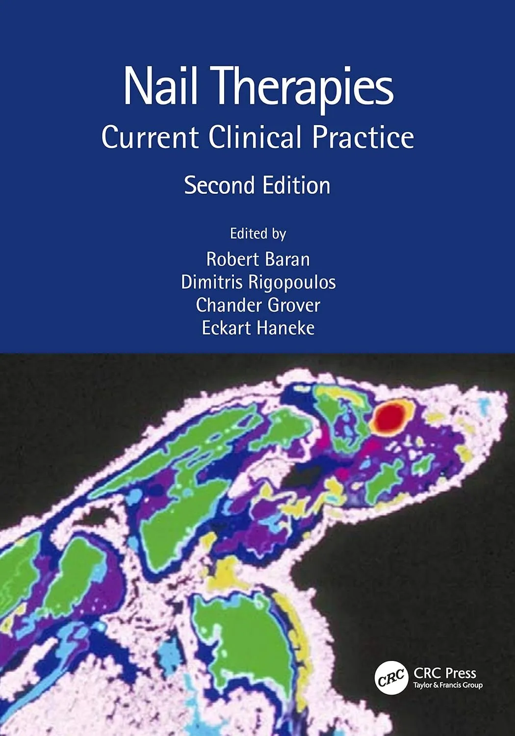 Nail Therapies Current Clinical Practice 2nd Edition | Paperback