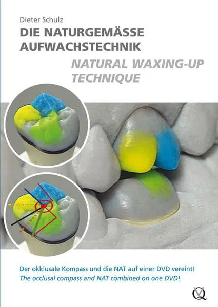 Natural Waxing-Up Technique | DVD Rom Only