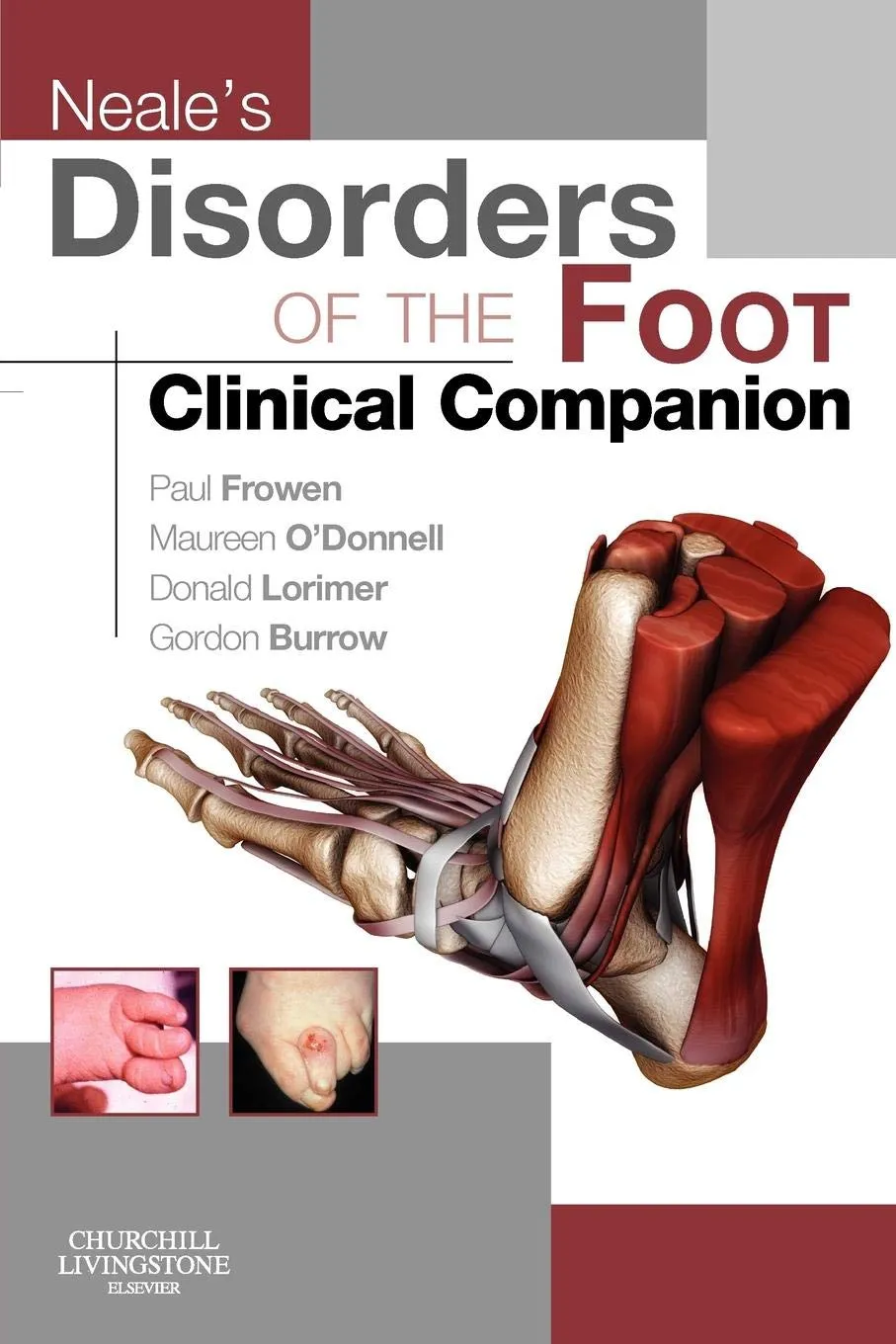 Neale's Disorders of the Foot Clinical Companion | Paperback