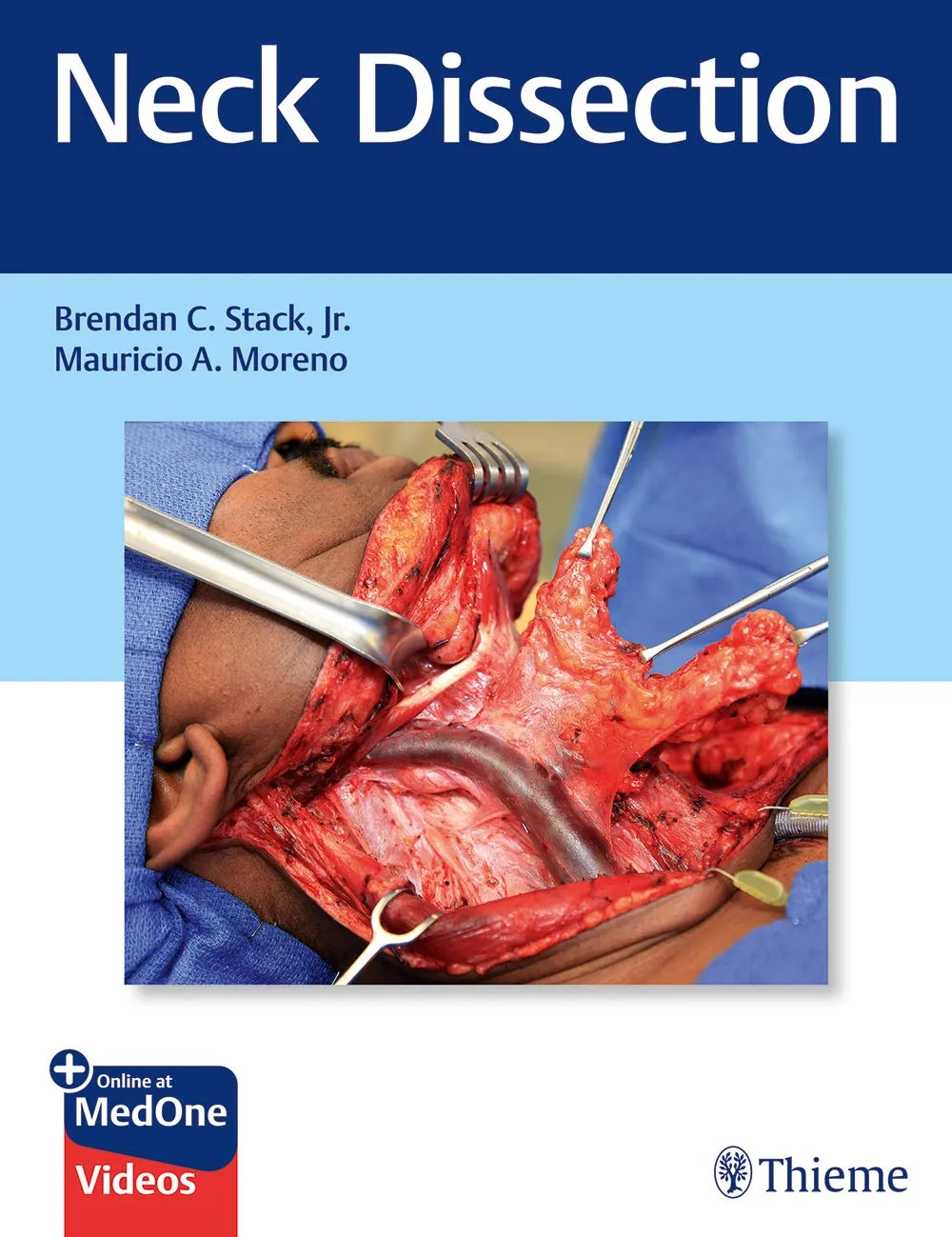 Neck Dissection | Hardcover