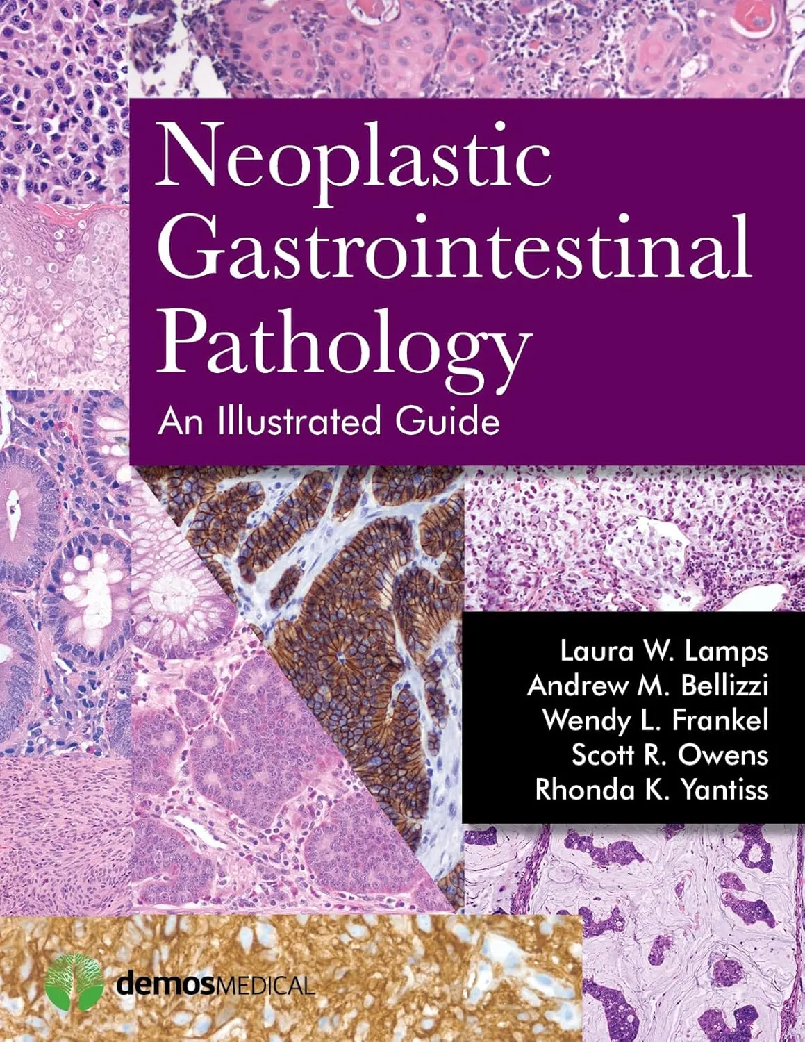 Neoplastic Gastrointestinal Pathology An Illustrated Guide | Hardcover