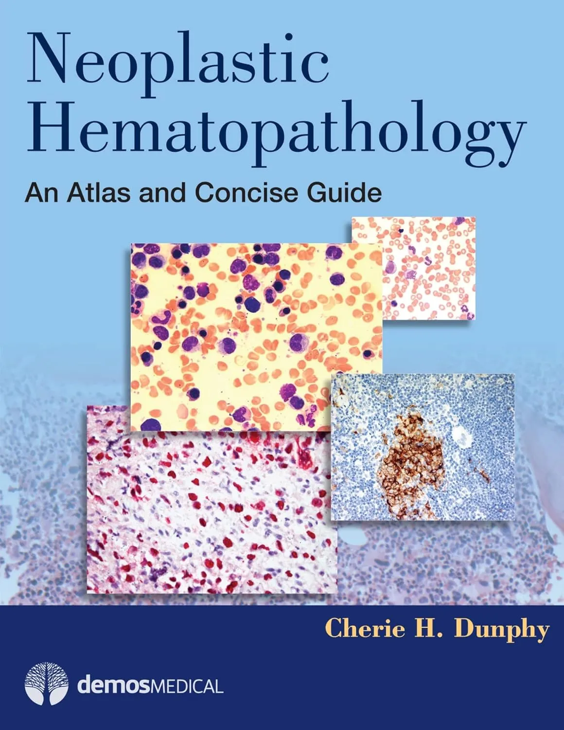 Neoplastic Hematopathology An Atlas and Concise Guide | Hardcover