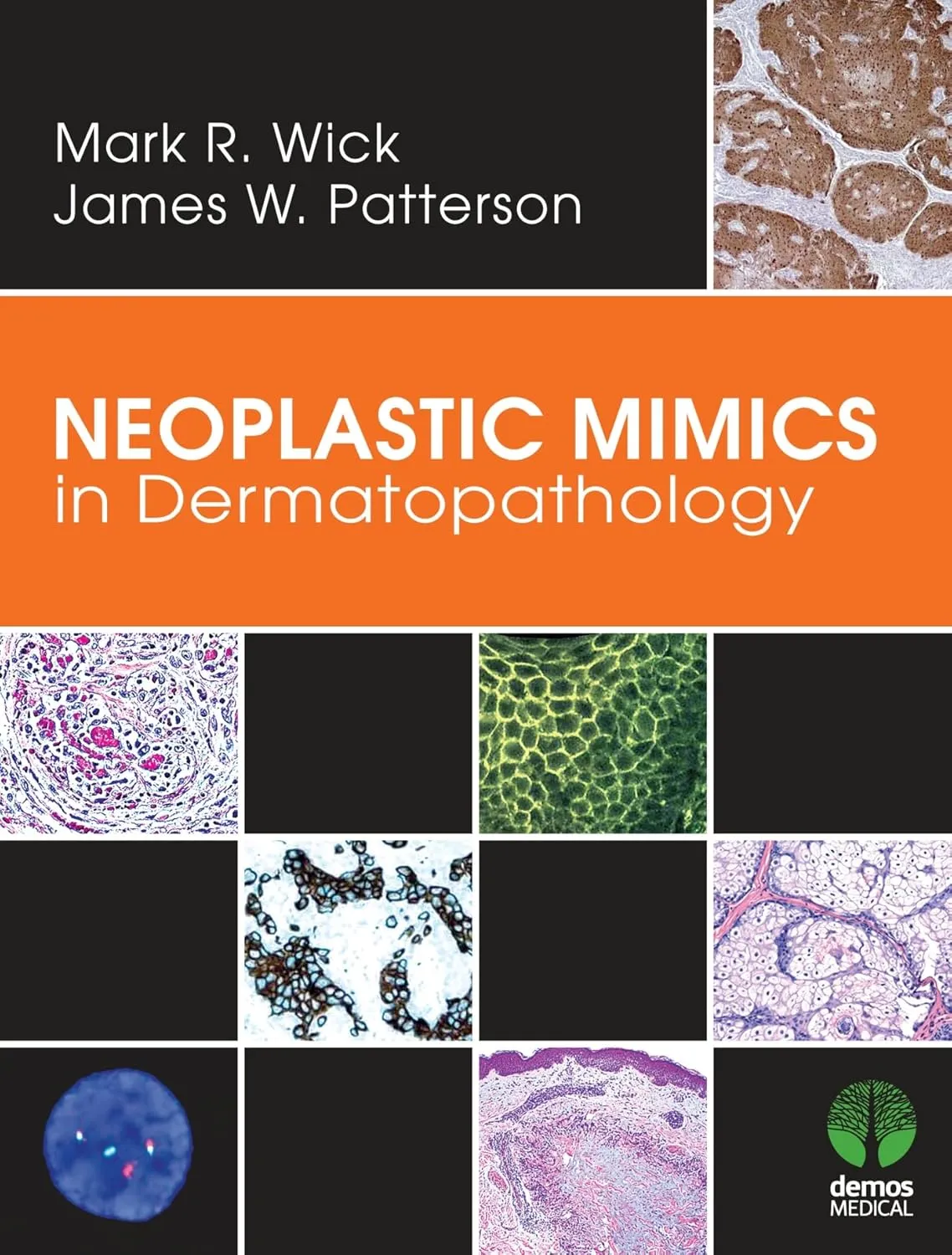 Neoplastic MIMICS in Dermatopathology | Hardcover