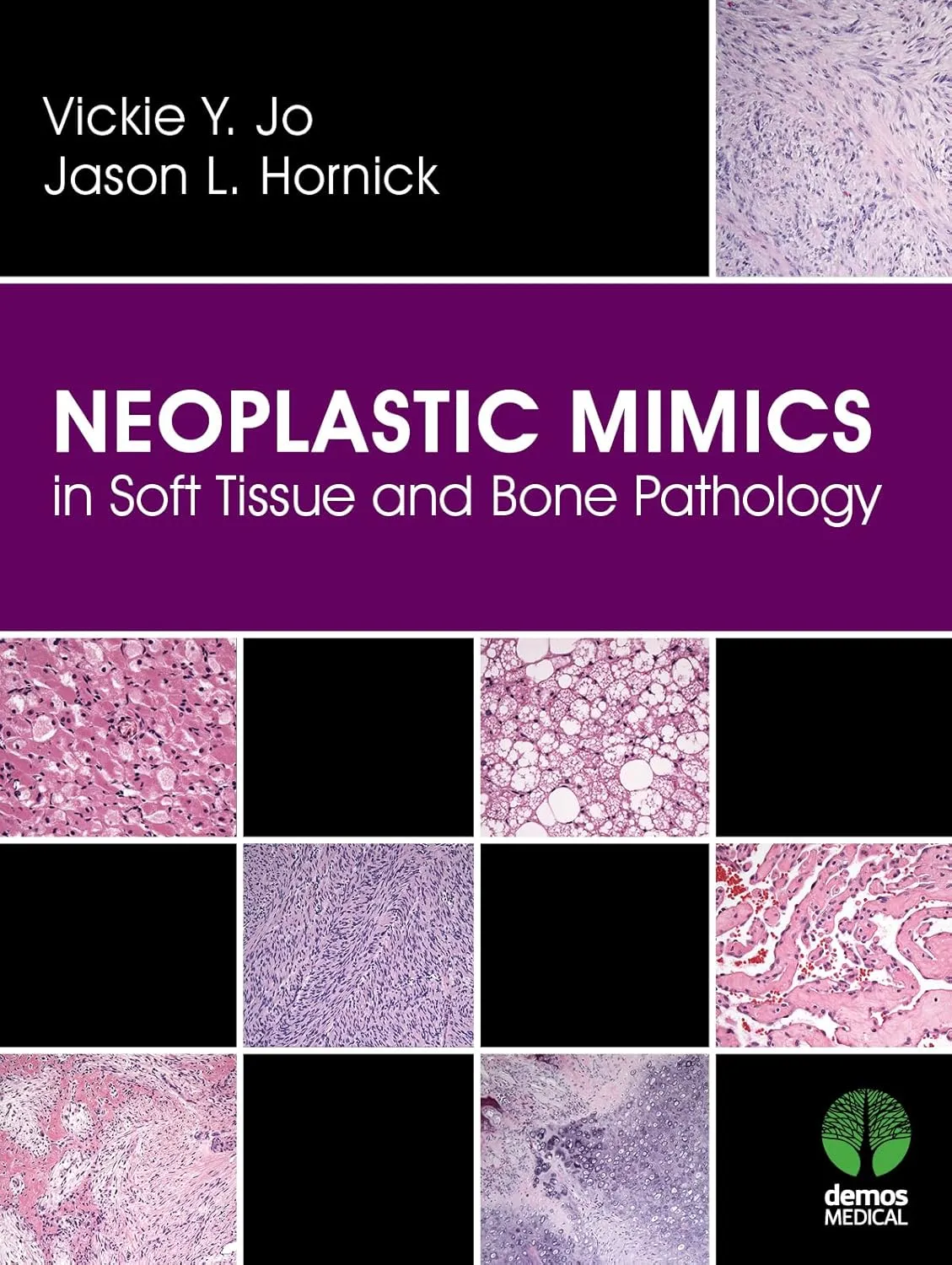 Neoplastic MIMICS in Soft Tissue and Bone Pathology | Hardcover