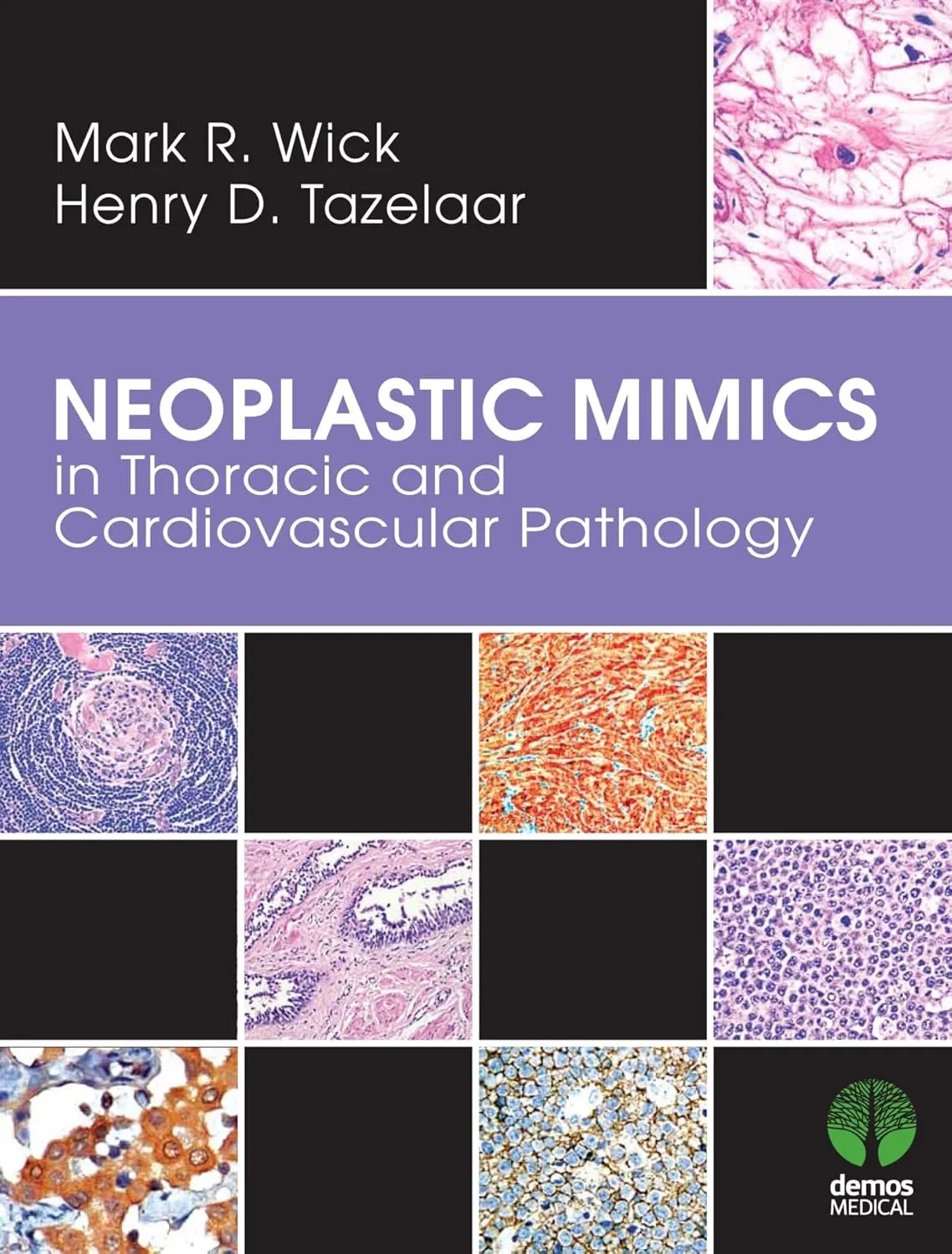 Neoplastic MIMICS in Thoracis and Cardiovascular Pathology | Hardcover