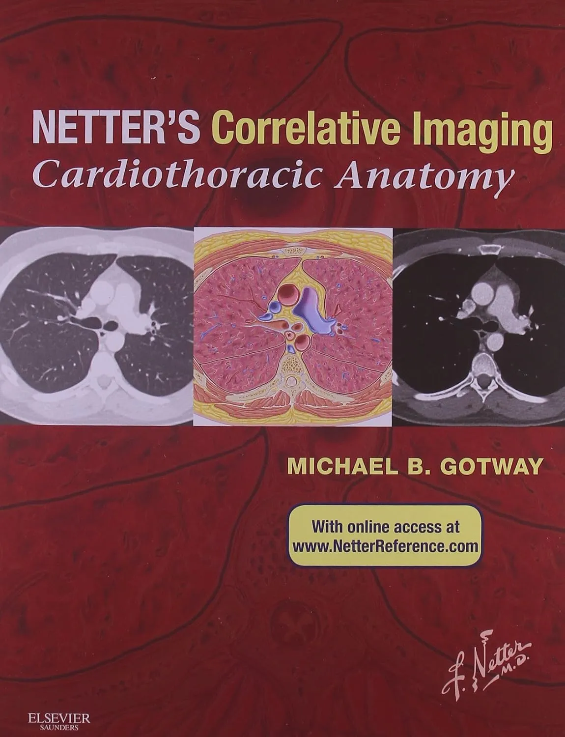 Netter's Correlative Imaging Cardiothoracic Anatomy | Hardcover