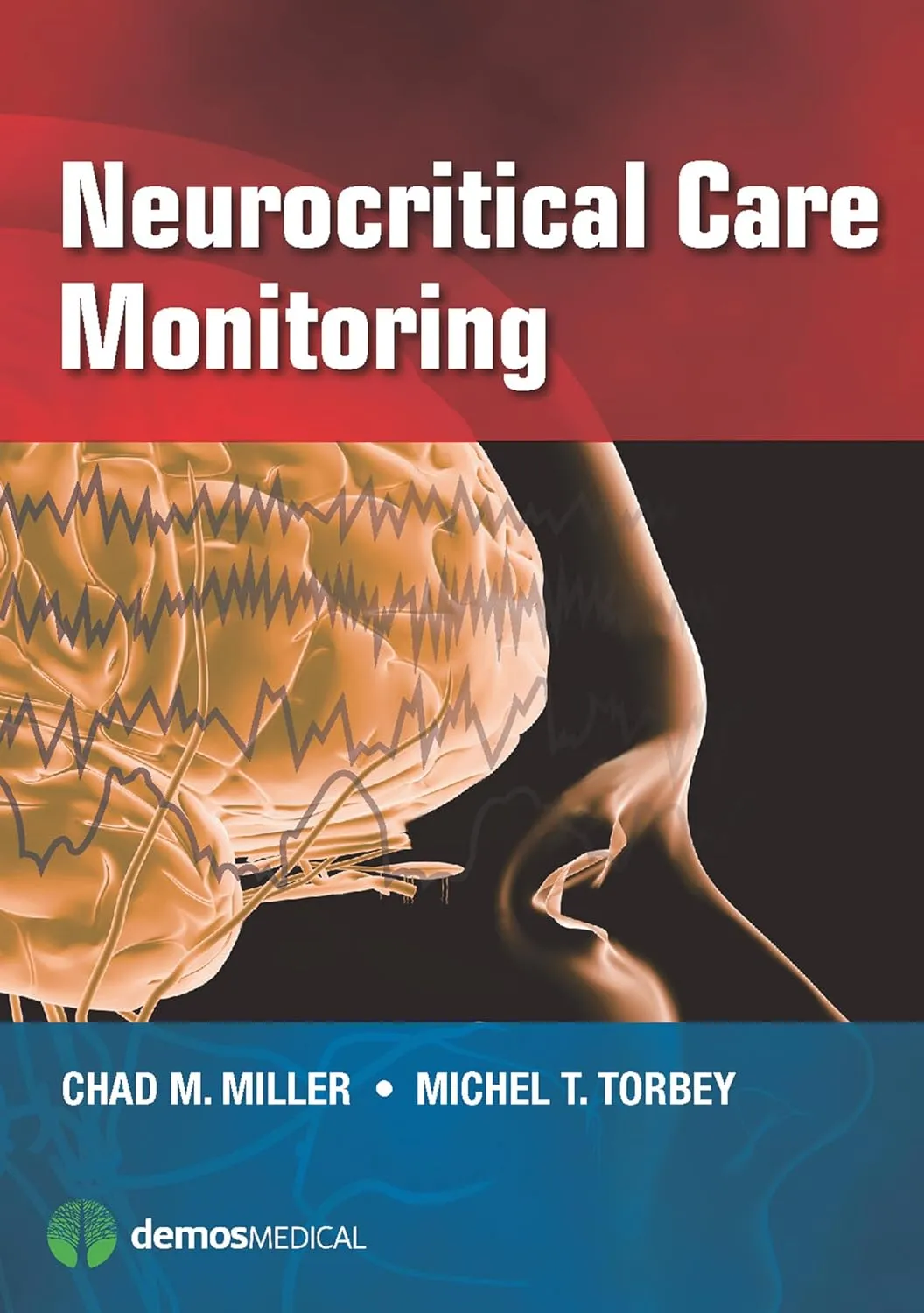 Neurocritical Care Monitoring | Paperback