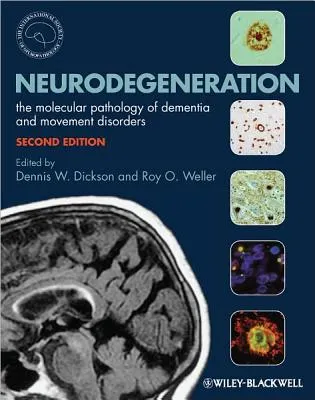 Neurodegeneration - The Molecular Pathology of Dementia and Movement Disorders 2nd Edition