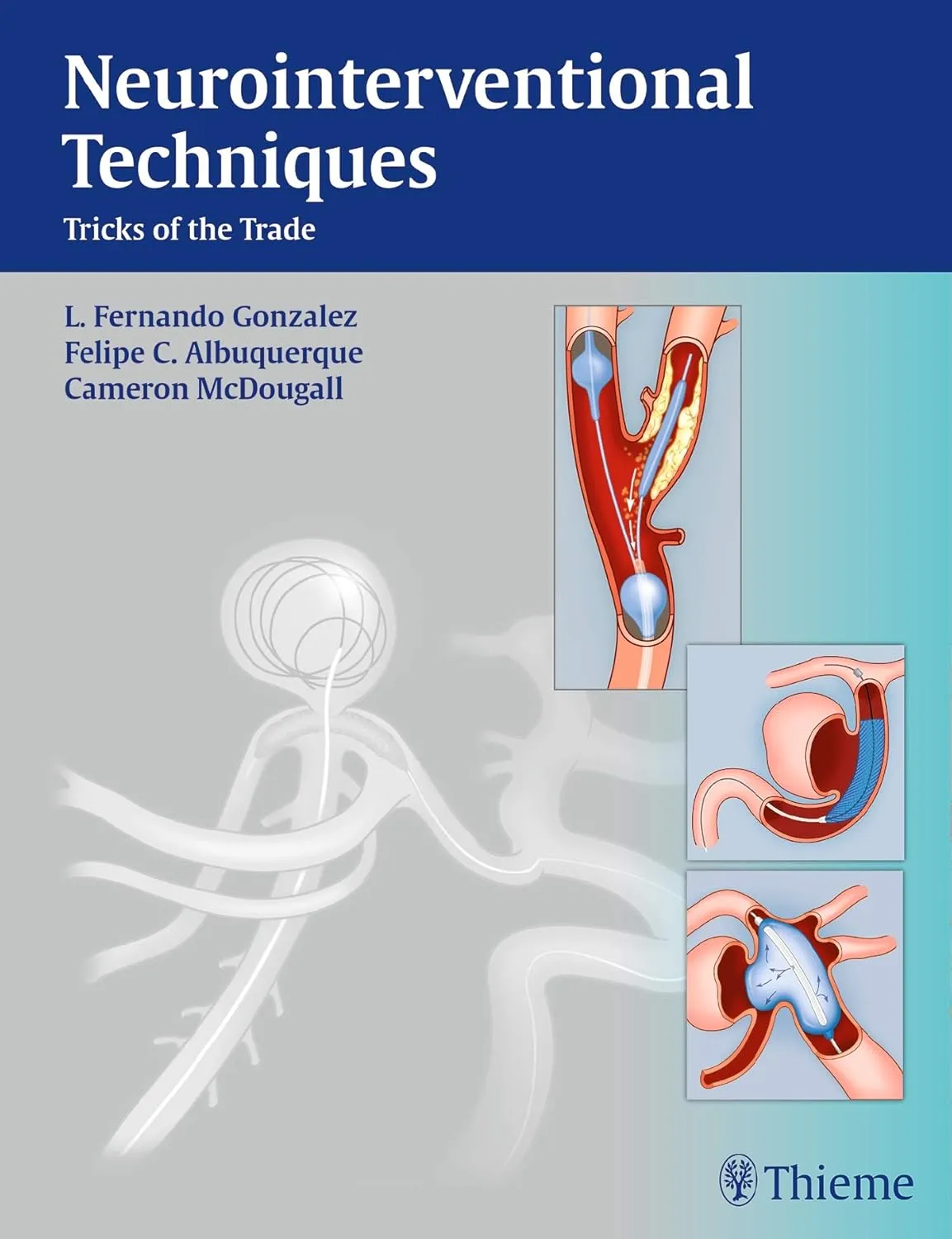 Neurointerventional Techniques Tricks of the Trade | Hardcover