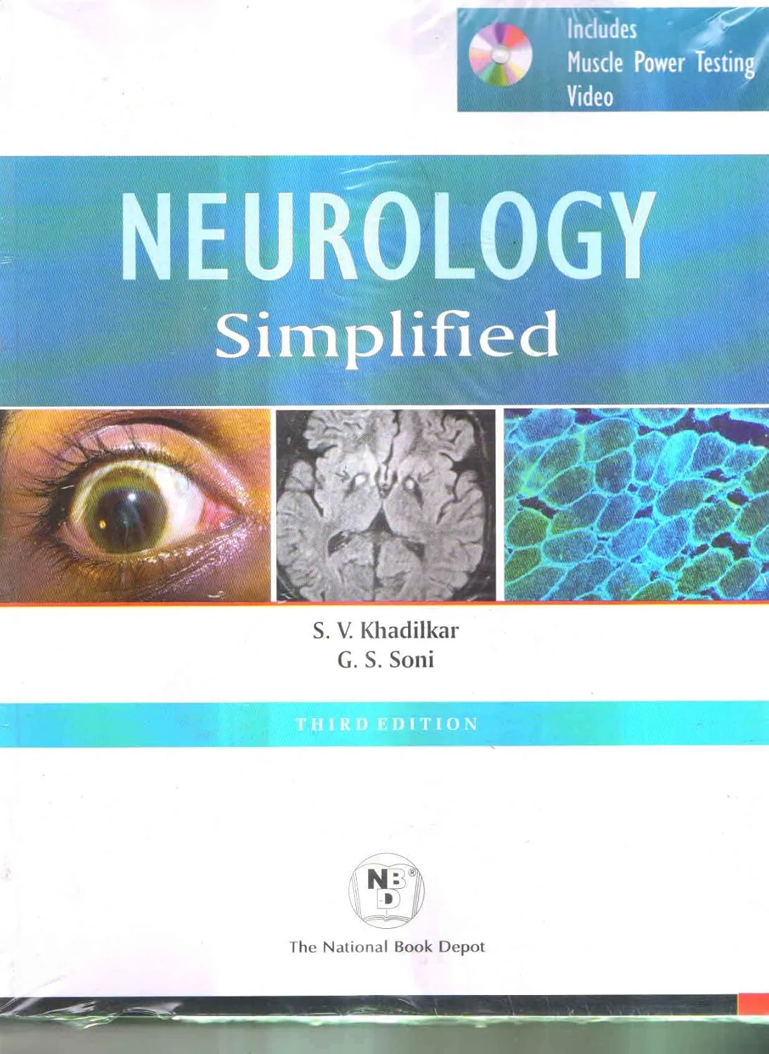 Neurology Simplified | Third Edition | With CD | Paperback