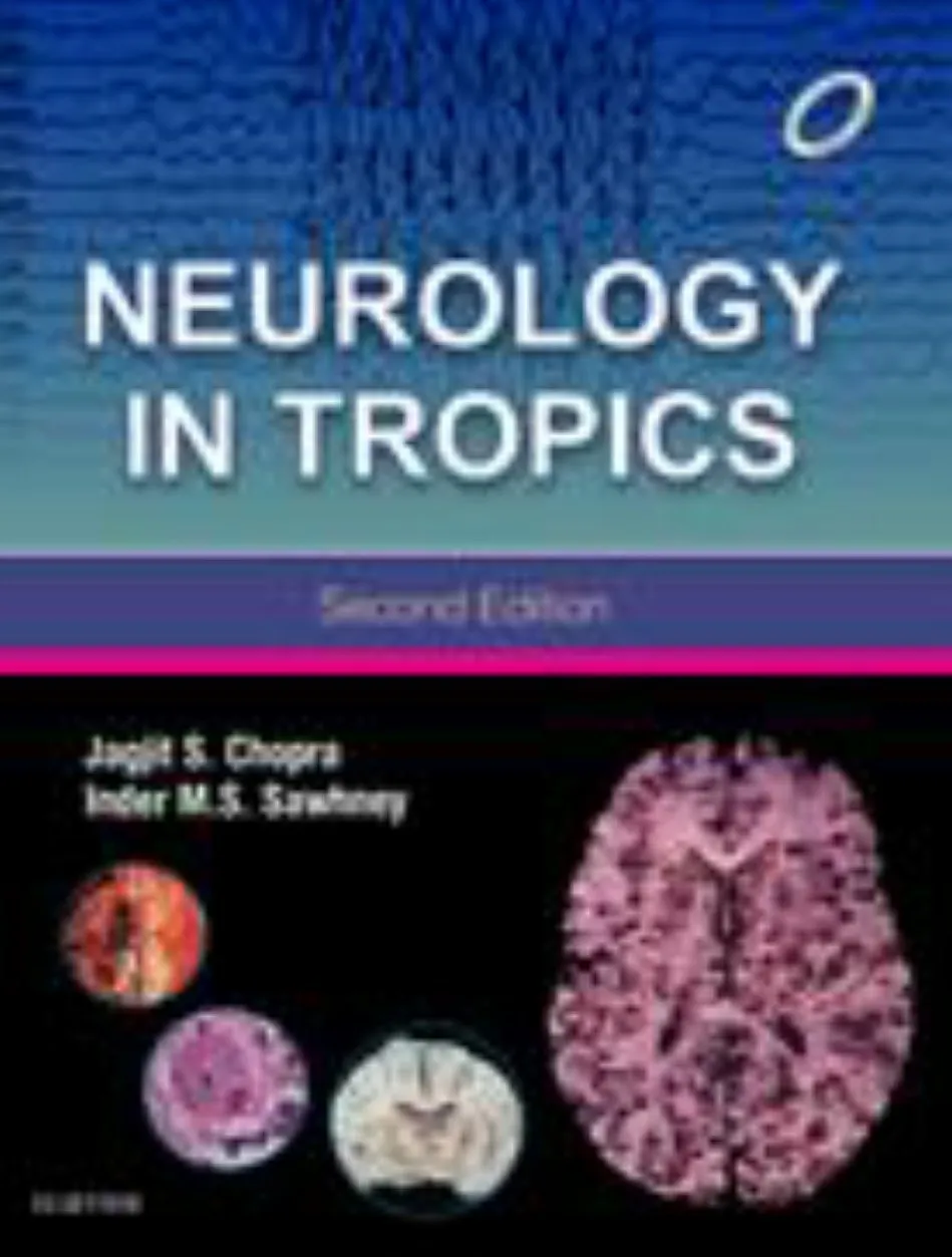 Neurology in Tropics | 2nd Edition | Hardcover
