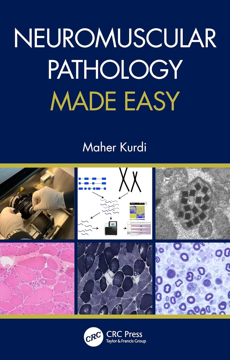 Neuromuscular Pathology Made Easy | Paperback