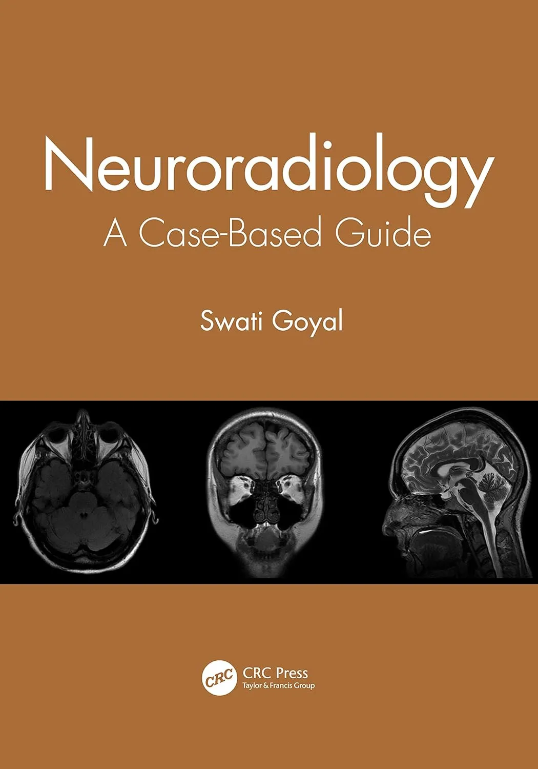 Neuroradiology A Case Based Guide | Paperback