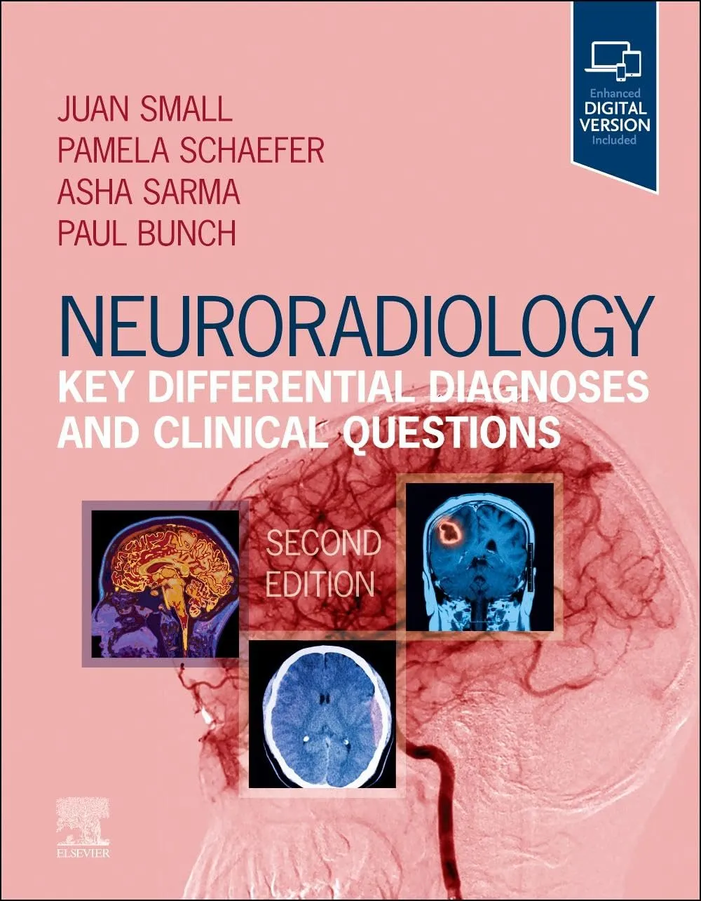 Neuroradiology Key Differential Diagnoses And Clinical Questions With Access Code 2nd Edition | Paperback