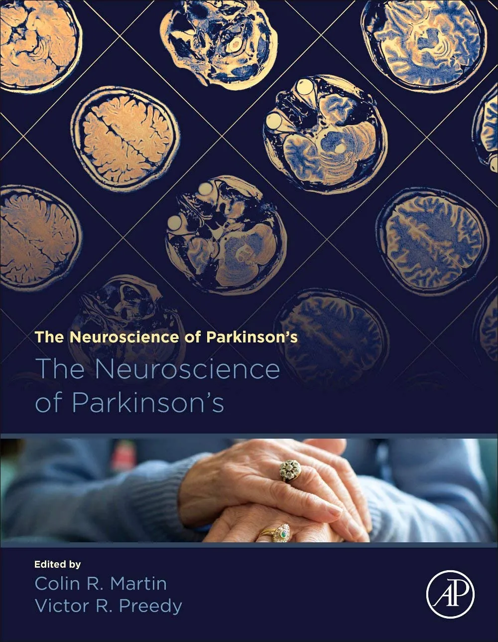 The Neuroscience Of Parkinsons Disease Diagnosis And Managements In Parkinsons Disease 2 Vol Set | Hardcover