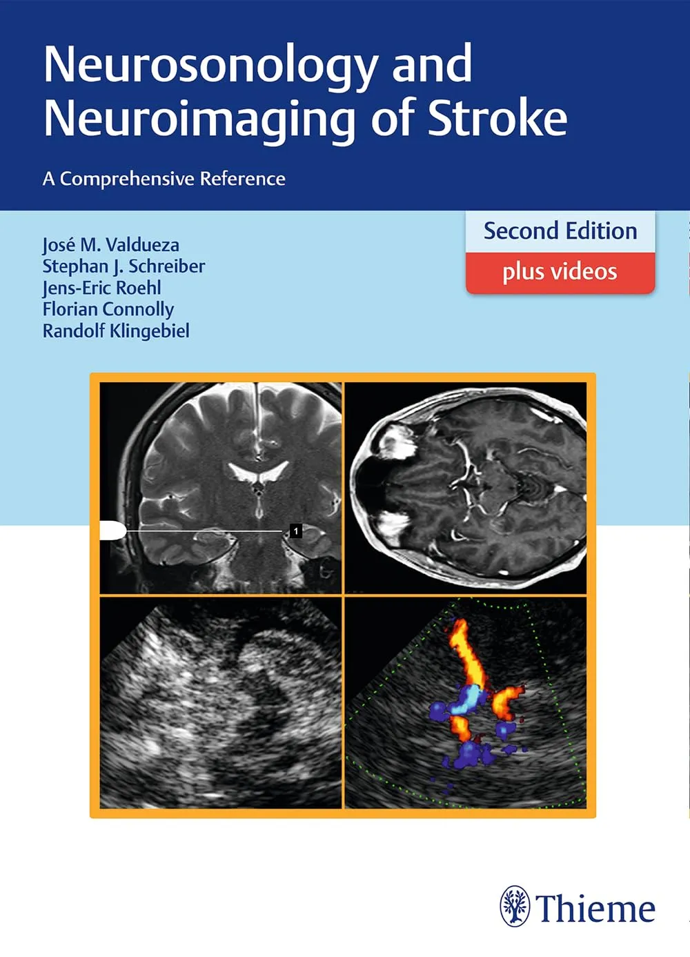 Neurosonology and Neuroimaging of Stroke | 2nd Edition | Hardcover