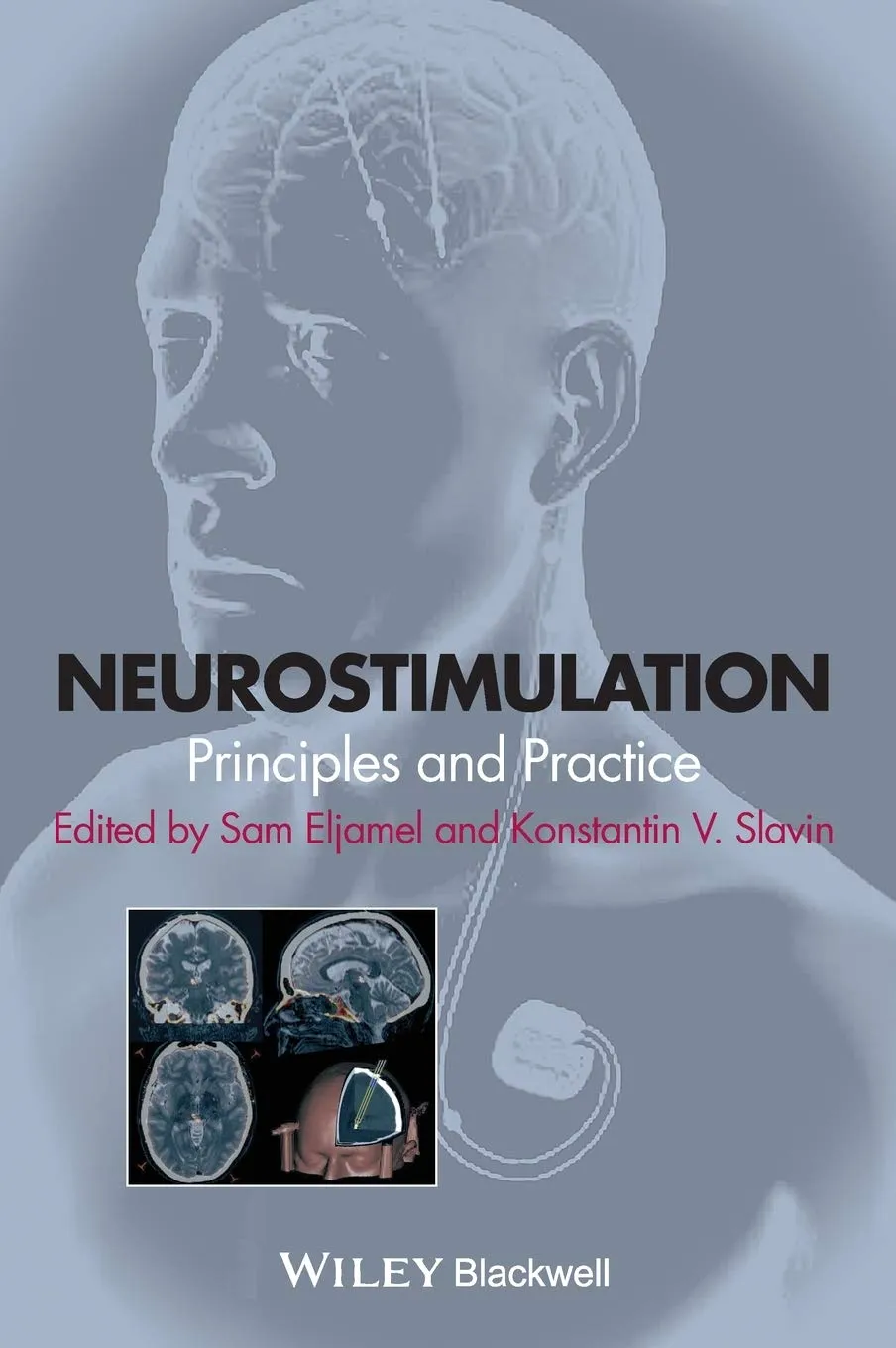 Neurostimulation Principles and Practice | Hardcover