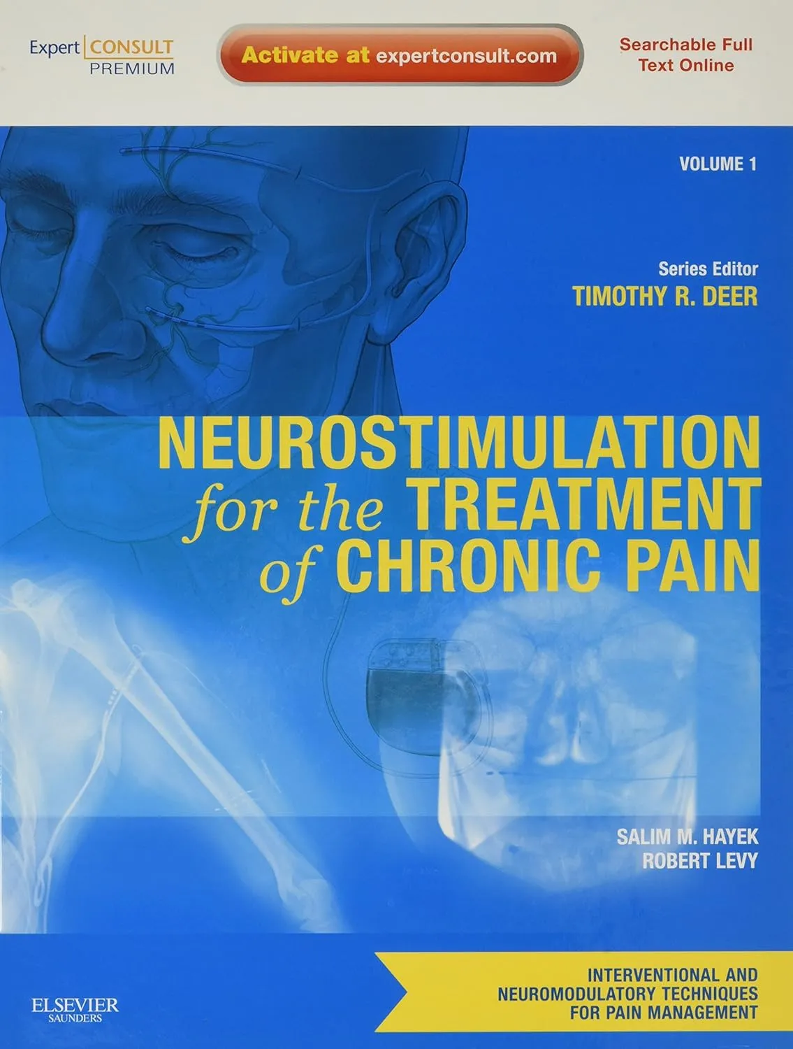 Neurostimulation for the Treatment of Chronic Pain | Volume 1 | Hardcover