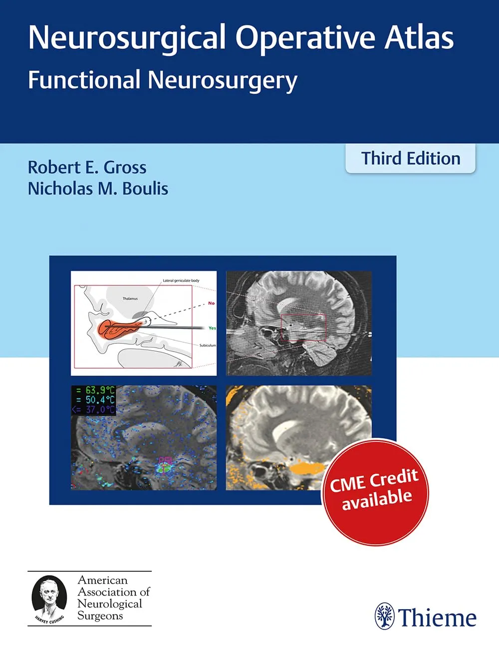 Neurosurgical Operative Atlas Functional Neurosurgery | Third Edition | Hardcover