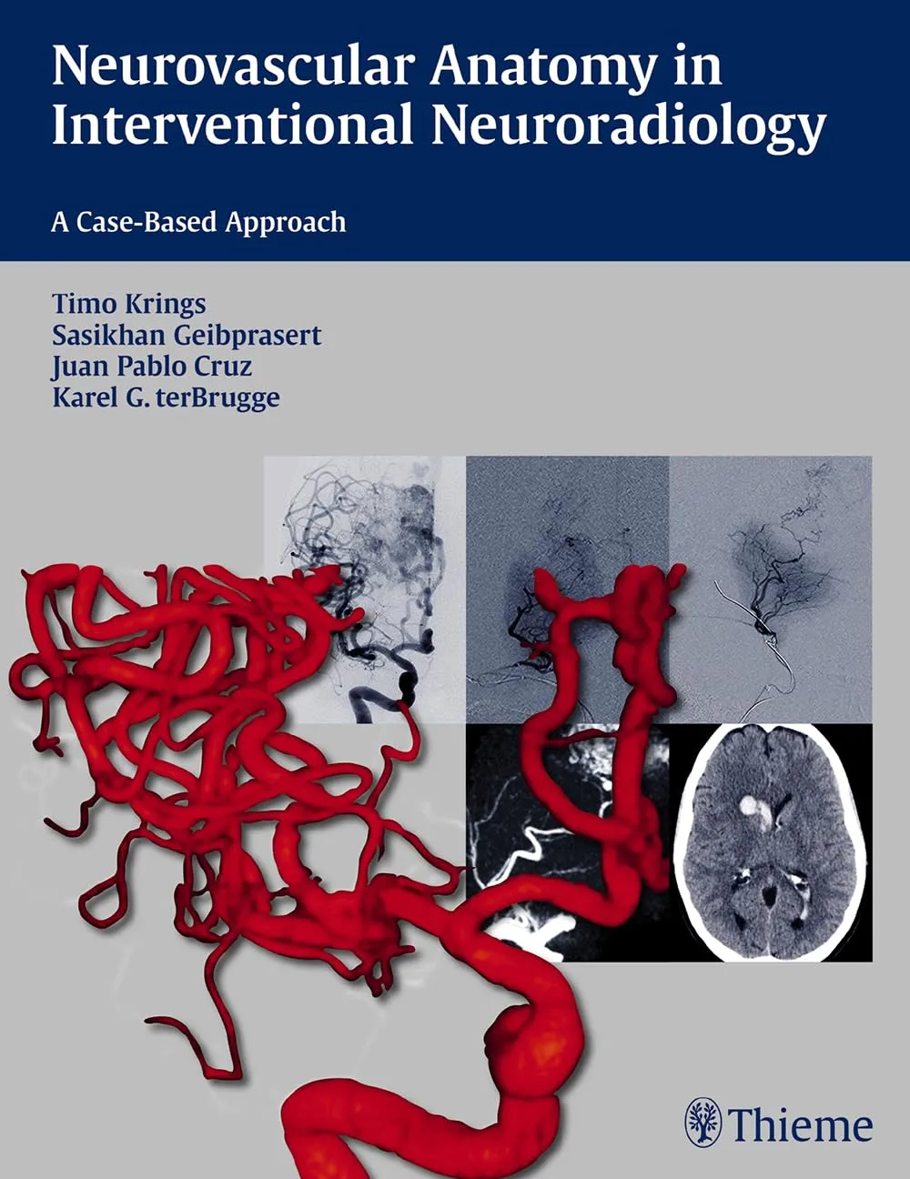Neurovascular Anatomy in Interventional Neuroradiology | Paperback