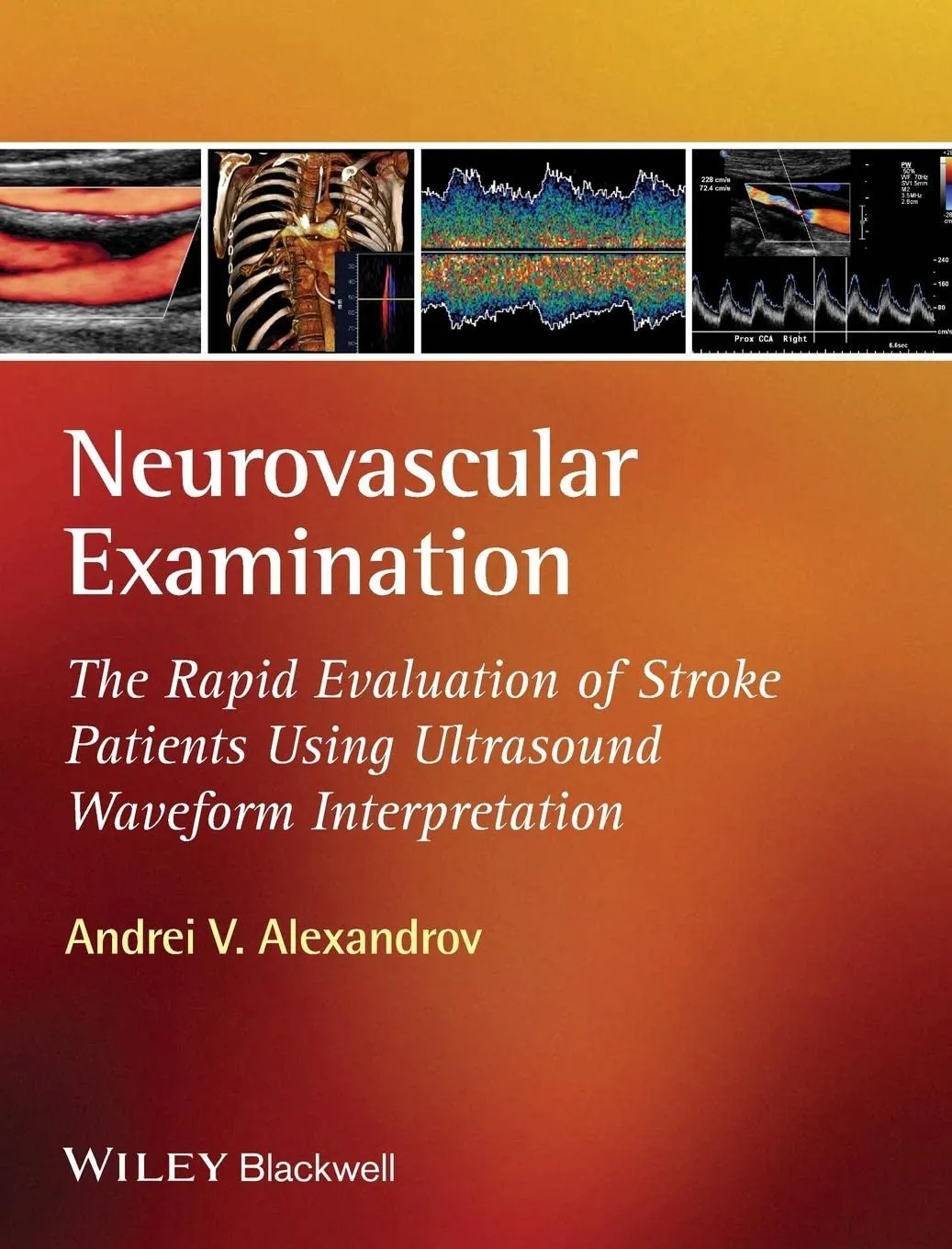 Neurovascular Examination The Rapid Evaluation of Stroke Patients Using Ultrasound Waveform Interpretation | Hardcover
