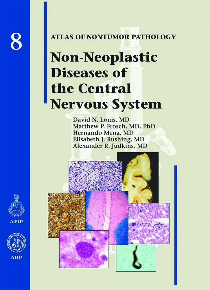 Non-Neoplastic Diseases of the Central Nervous System | Series 8 | Hardcover
