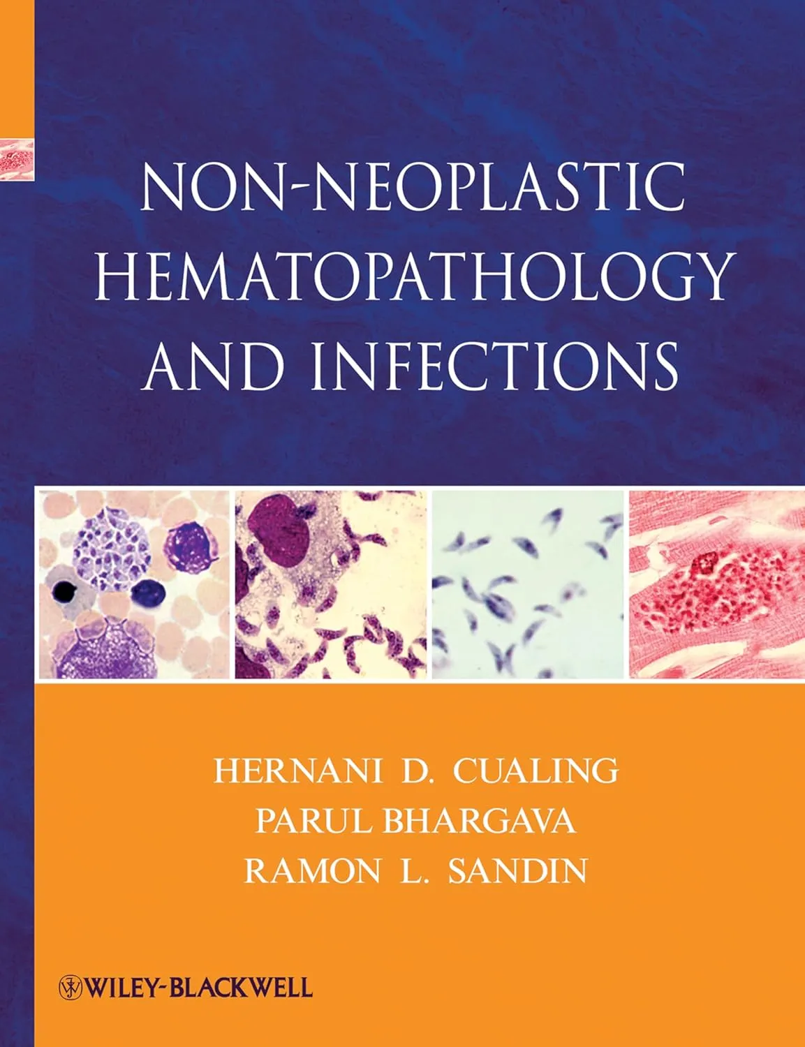 Non-Neoplastic Hematopathology and Infections | Hardcover
