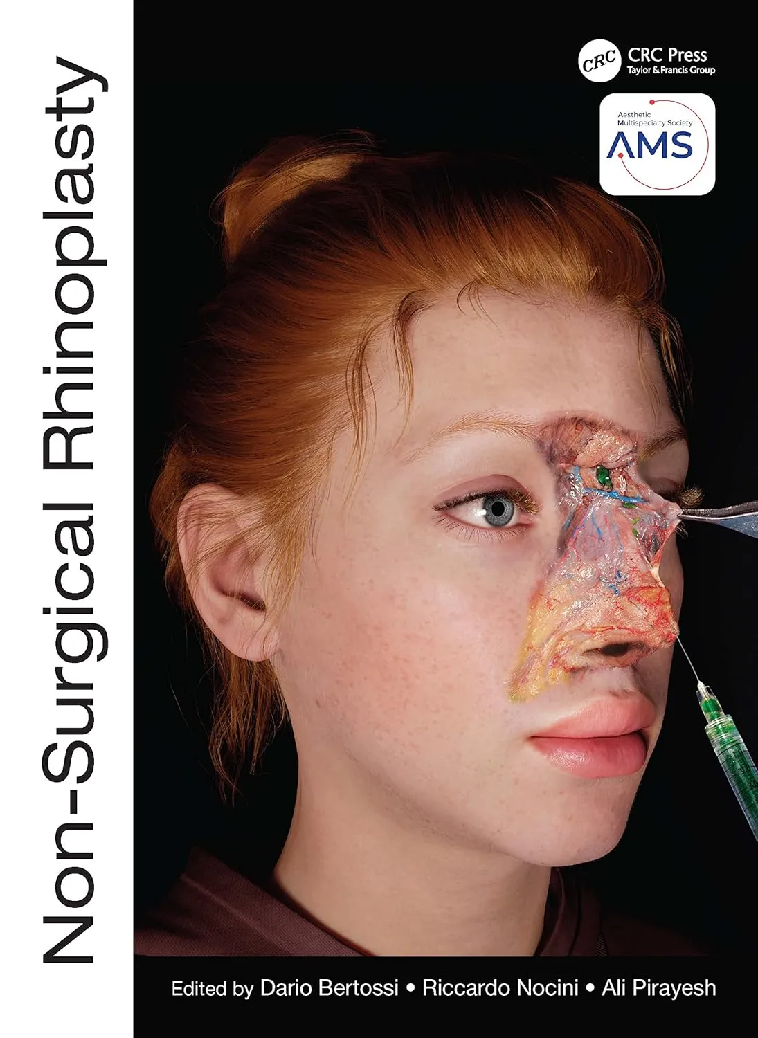 Non Surgical Rhinoplasty | Hardcover