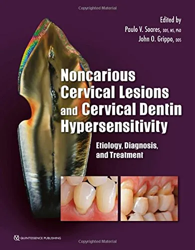 Noncarious Cervical Lesions and Cervical Dentin Hypersensitivity | Hardcover