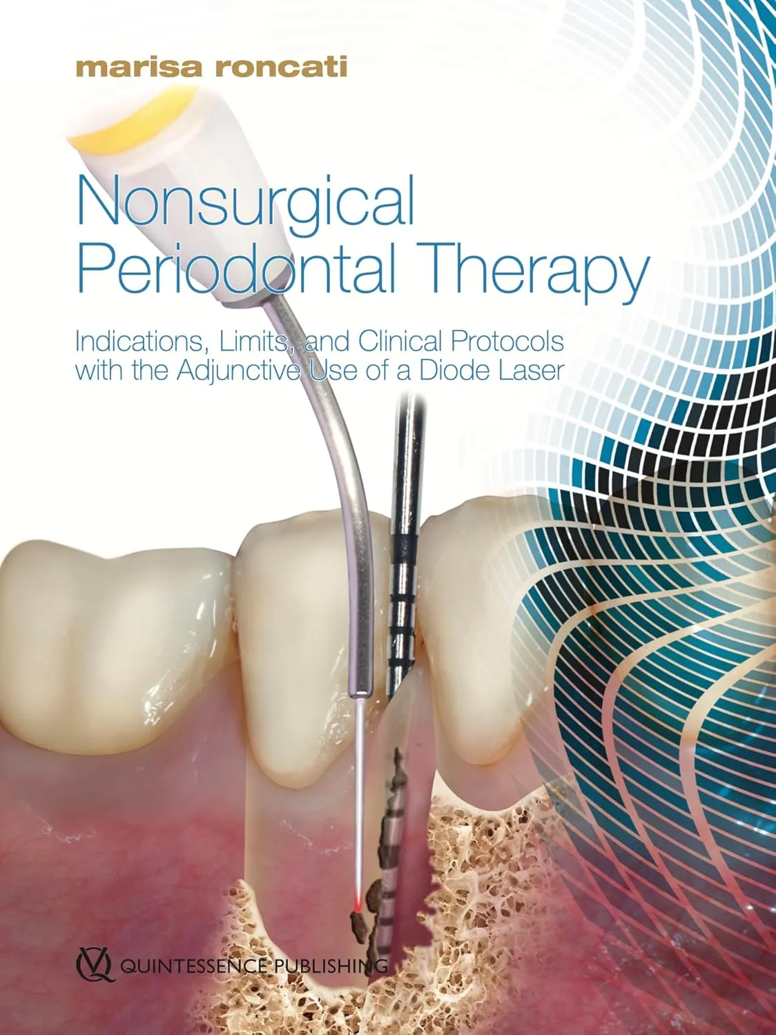 Nonsurgical Periodontal Therapy | Hardcover