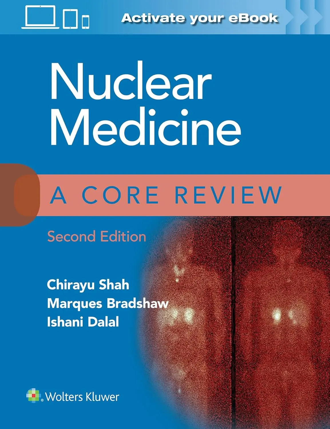 Nuclear Medicine A Core Review 2nd Edition | Paperback