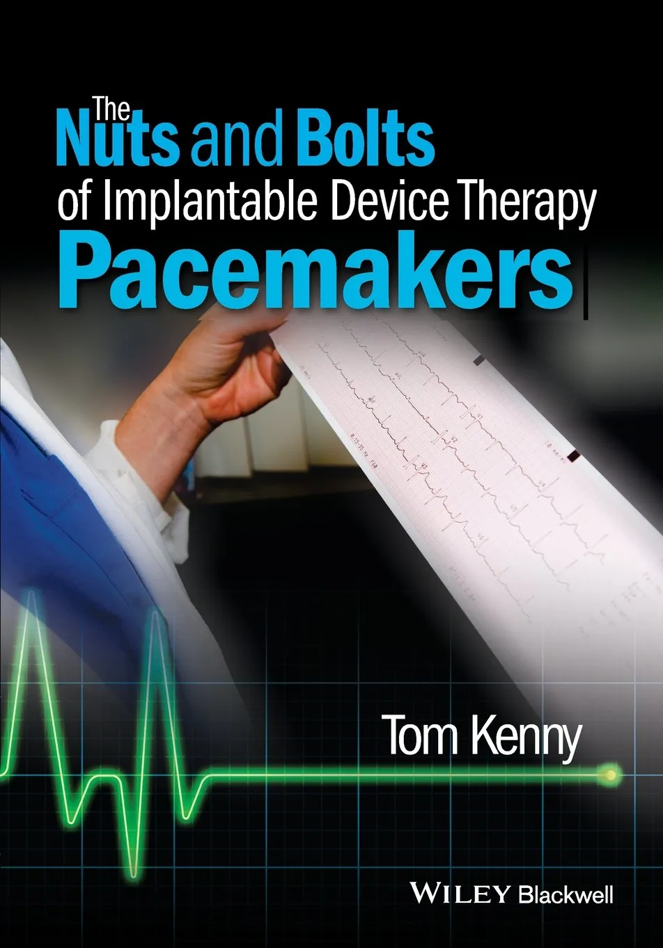 The Nuts and Bolts of Implantable Device Therapy Pacemakers | Paperback