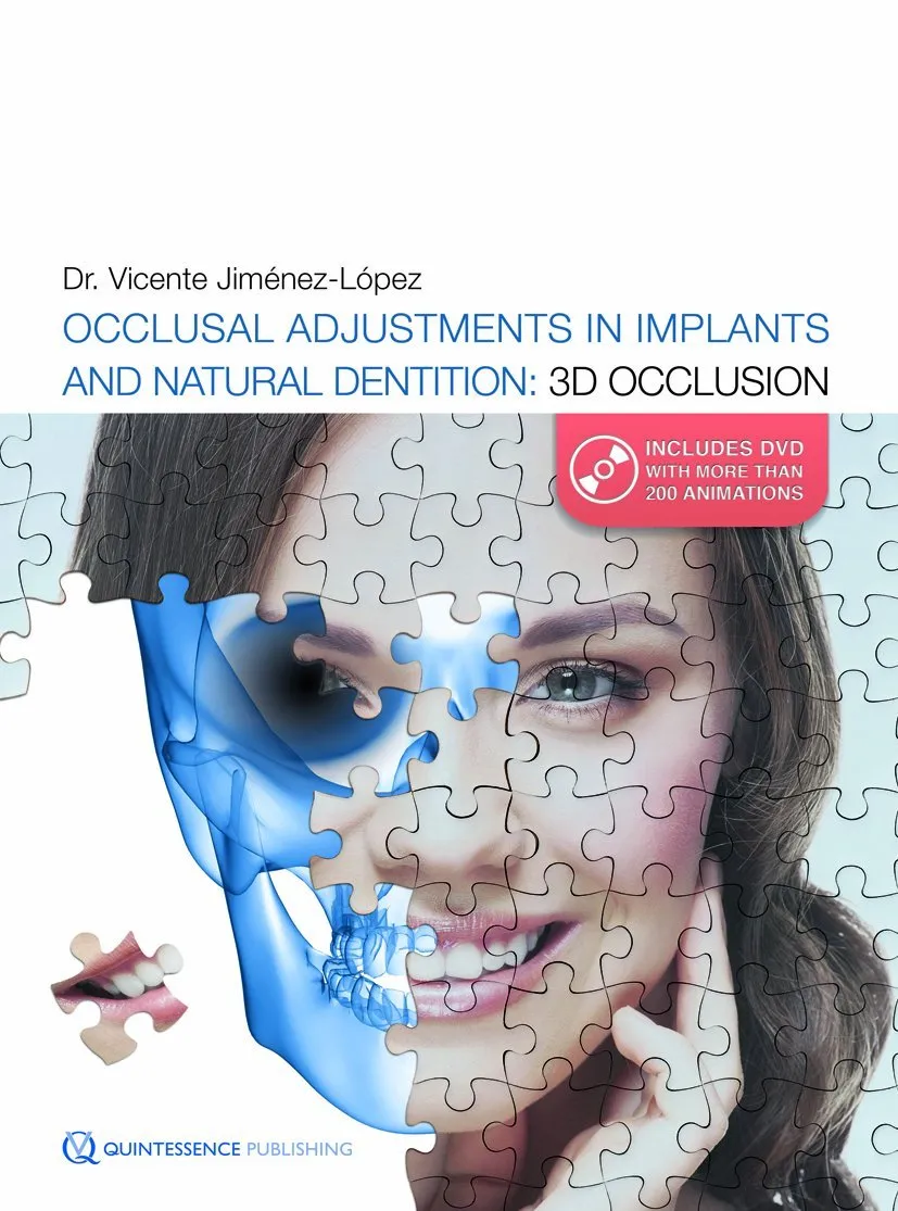 Occlusal Adjustments in Implants and Natural Dentition 3D Occlusion With DVD Rom | Hardcover