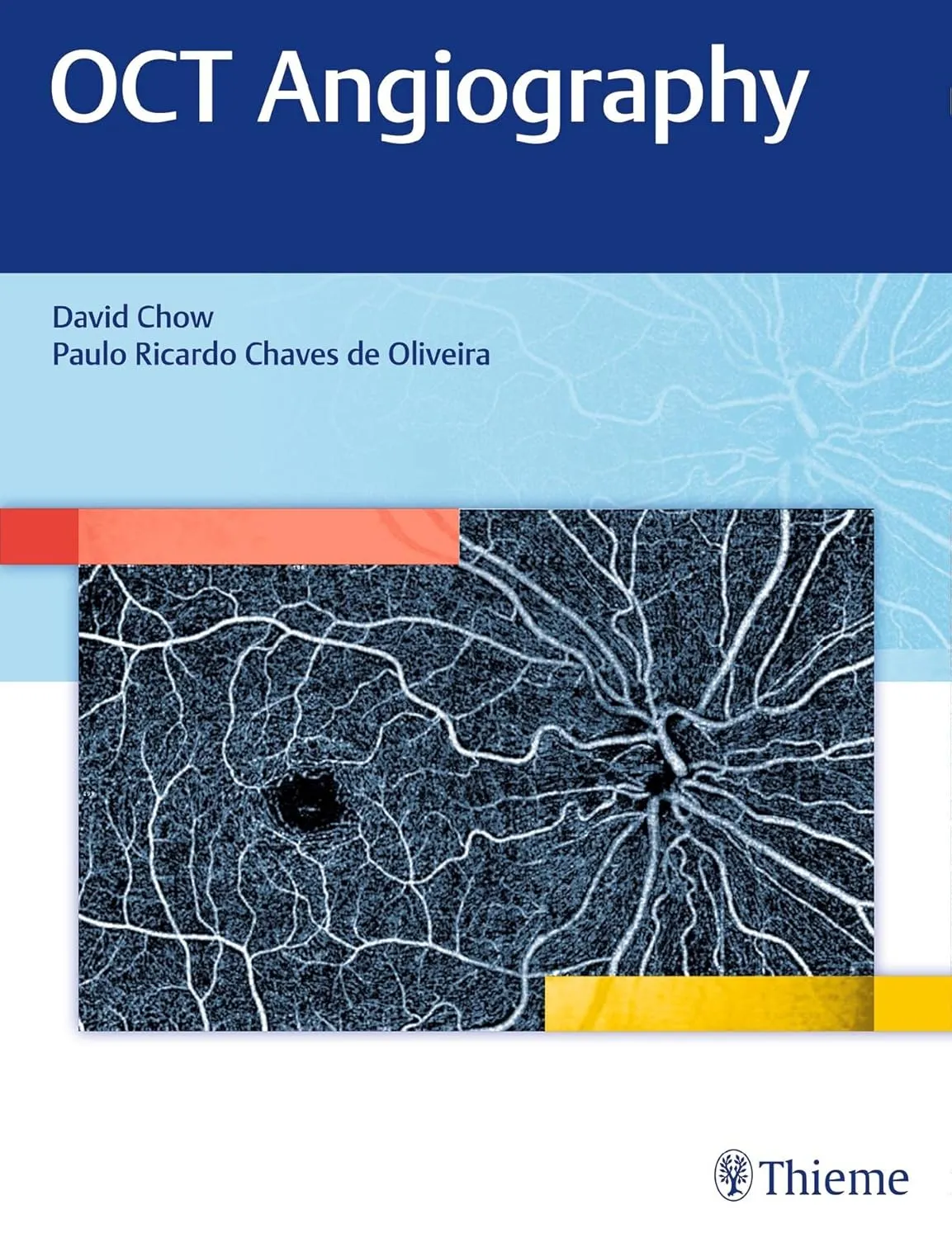 OCT Angiography | Hardcover