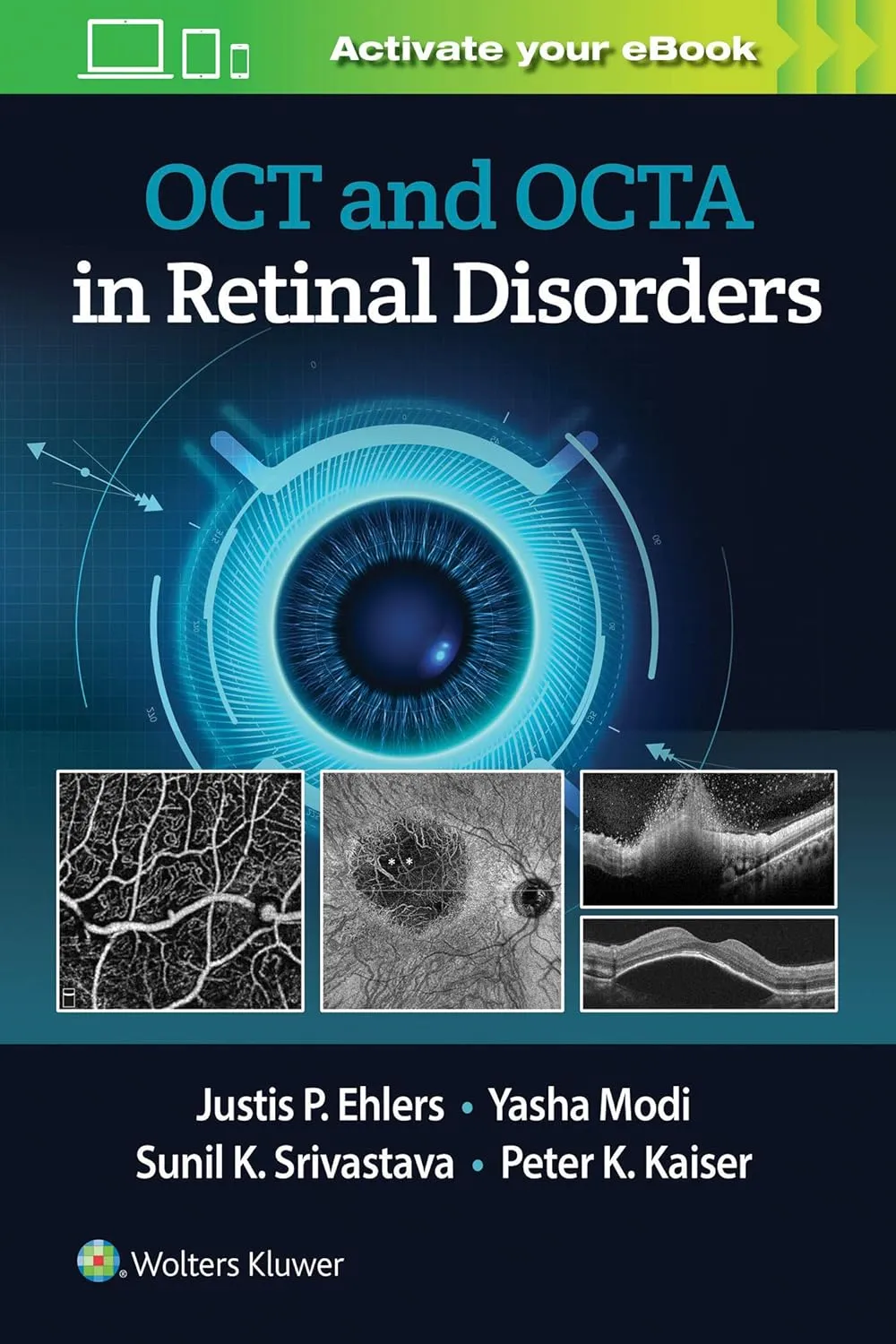 Oct and Octa In Retinal Disorders With Access Code | Paperback