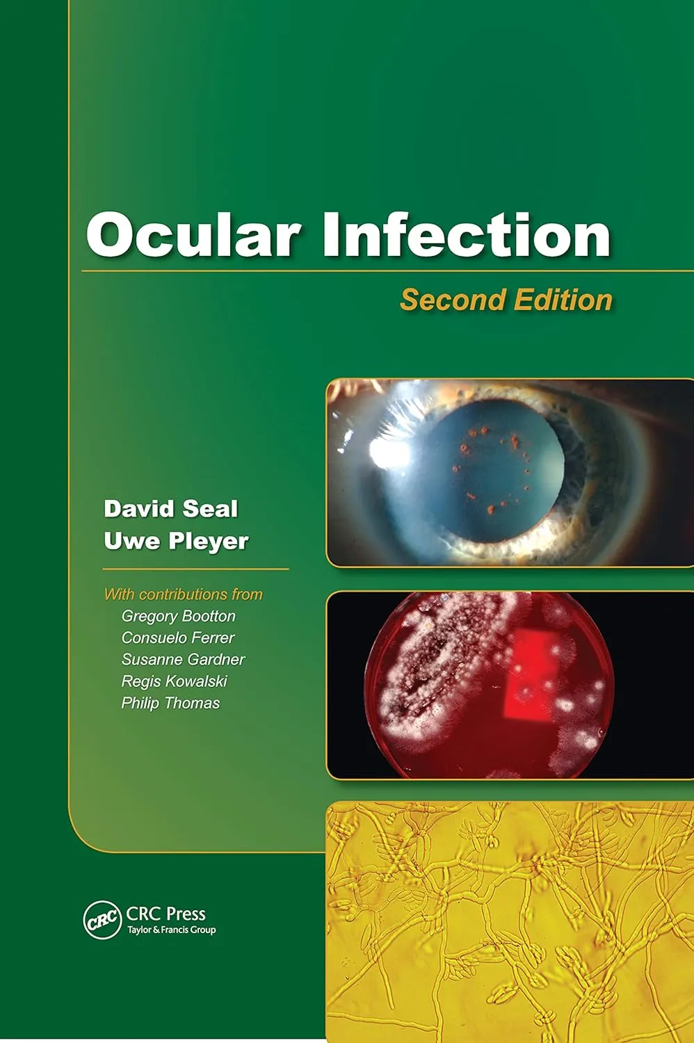 Ocular Infection | 2nd Edition | Hardcover