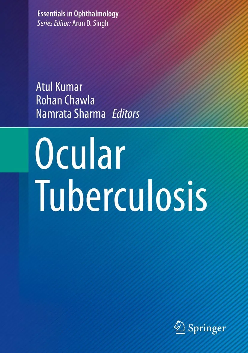 Ocular Tuberculosis | Hardcover