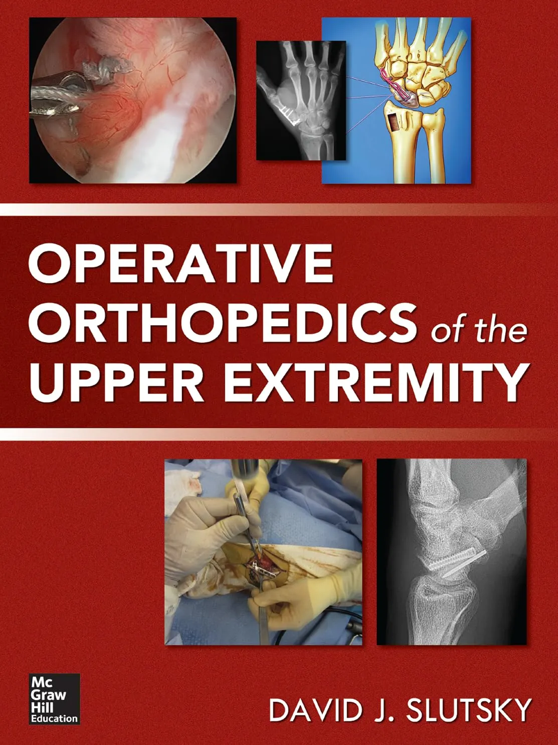 Operative Orthopedics of the Upper Extremity | Hardcover