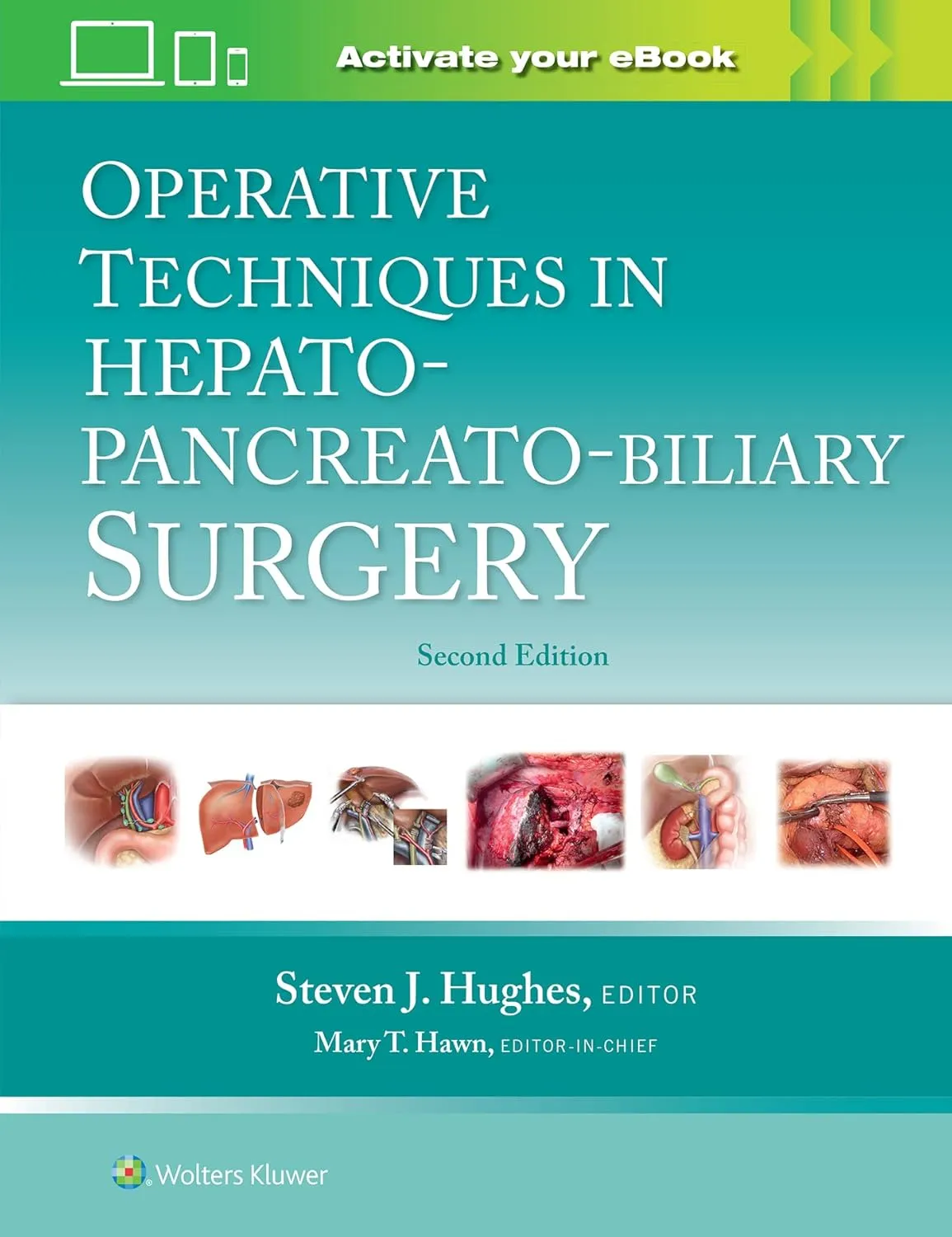 Operative Techniques In Hepato Pancreato Biliary Surgery With Access Code 2nd Edition | Hardcover