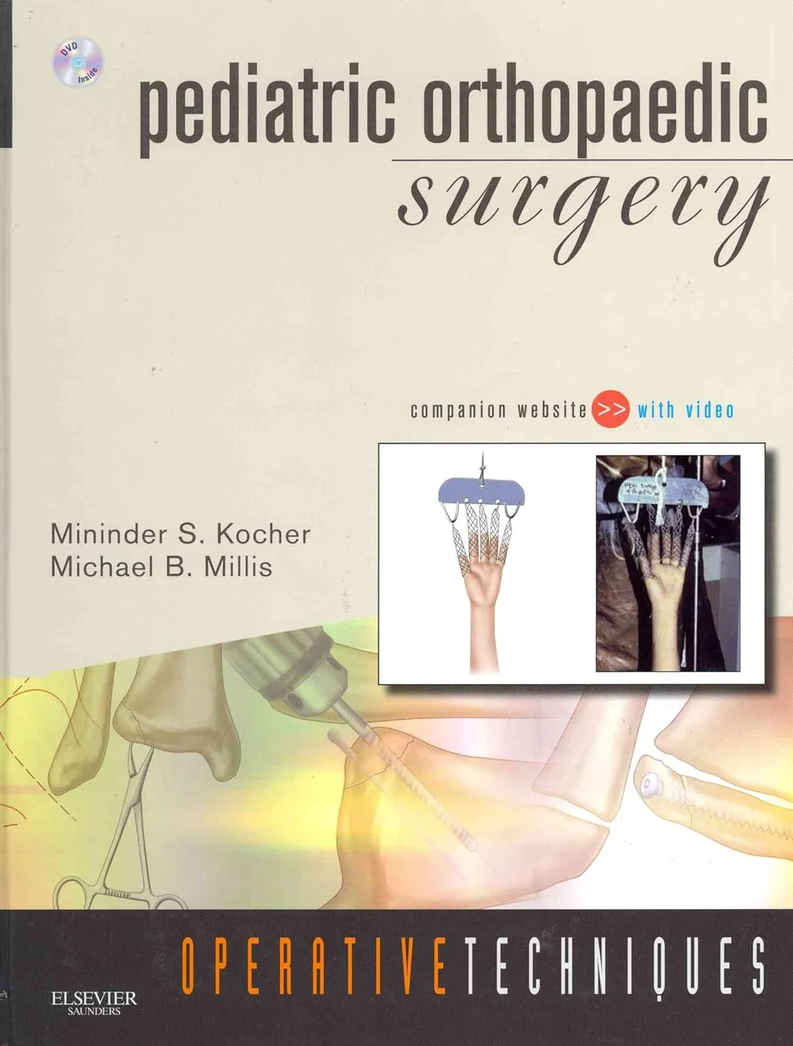 Operative Techniques Pediatric Orthopaedic Surgery | With DVD | Hardcover