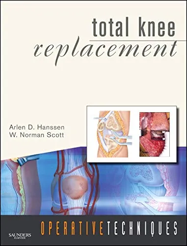 Operative Techniques Total Knee Replacement | With DVD | Hardcover