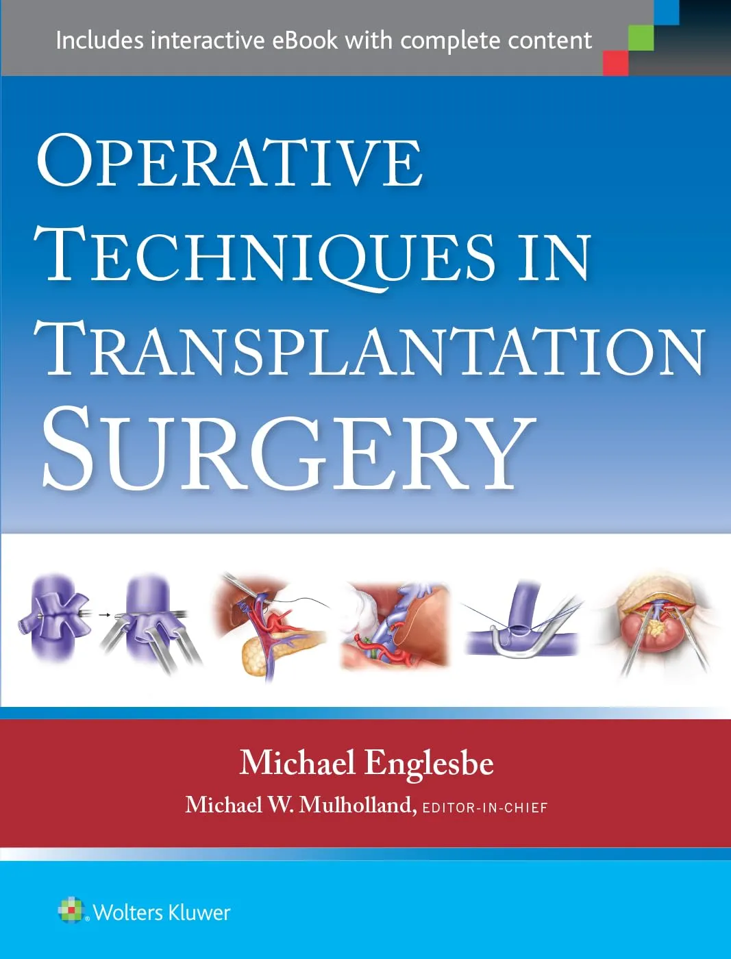 Operative Techniques in Transplantation Surgery | Hardcover