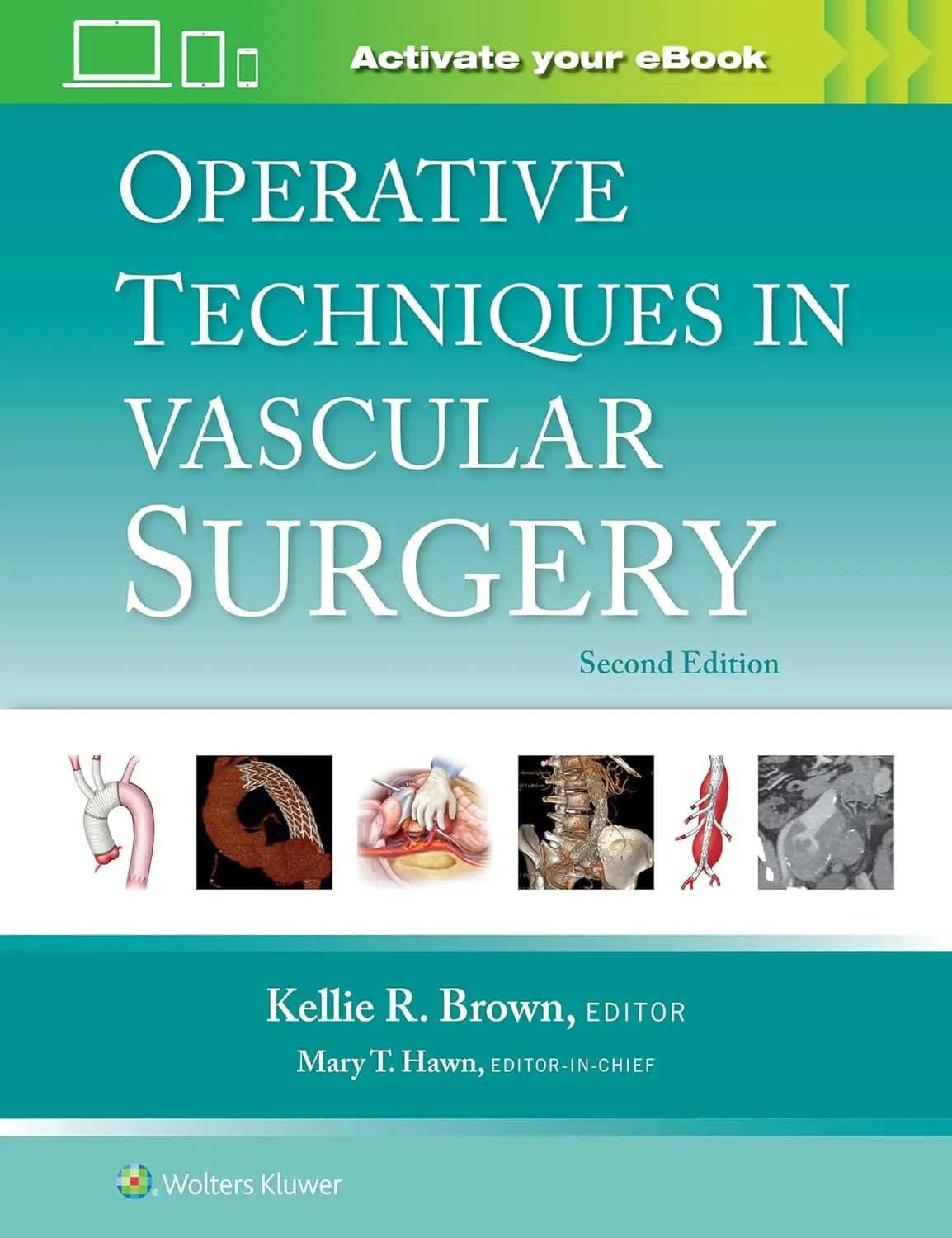 Operative Techniques In Vascular Surgery With Access Code 2nd Edition | Hardcover