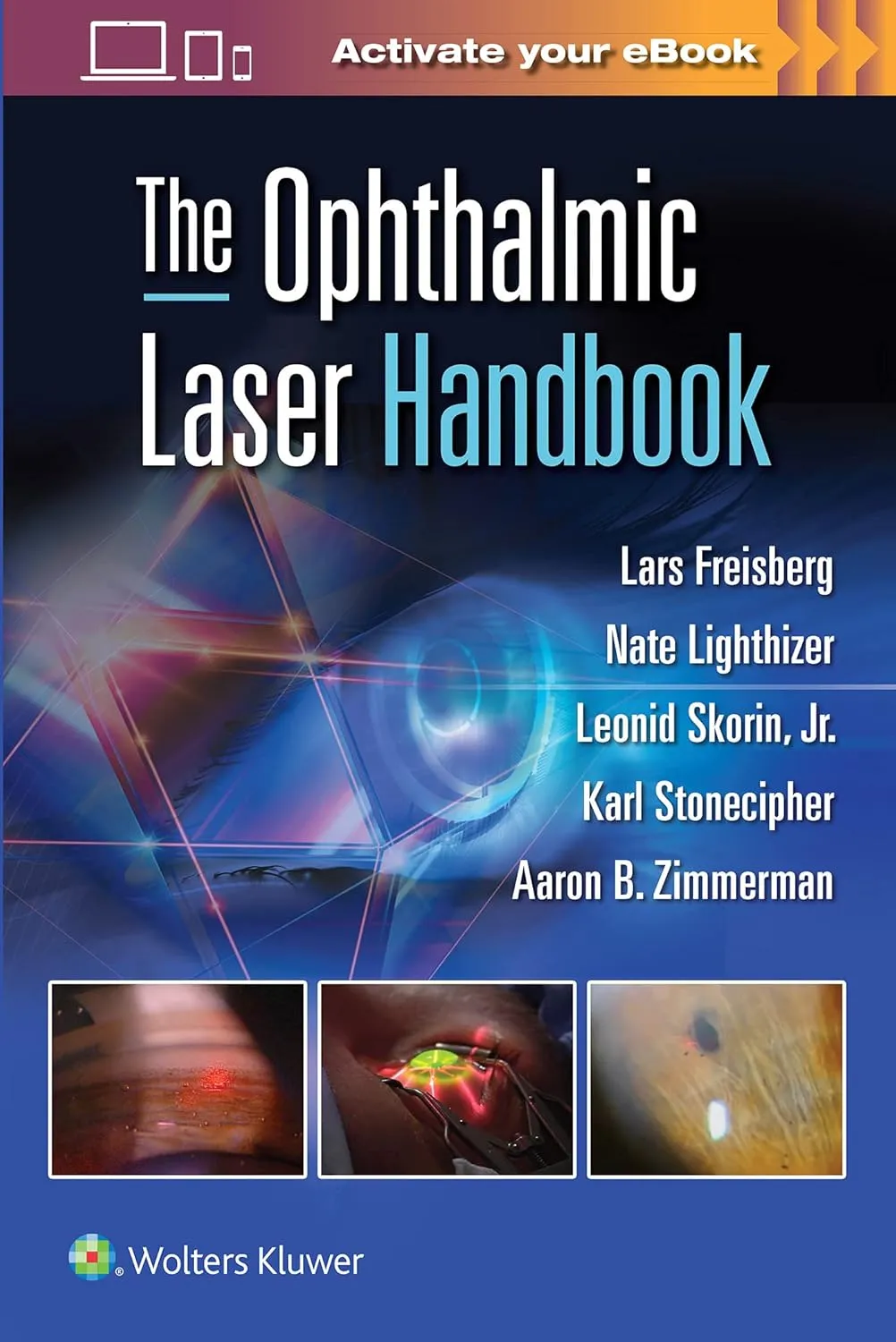 The Ophthalmic Laser Handbook | Paperback