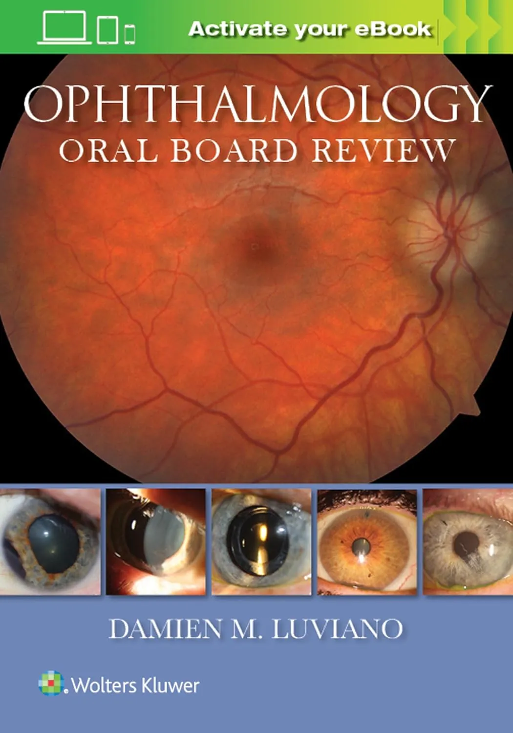 Ophthalmology Oral Board Review | Paperback