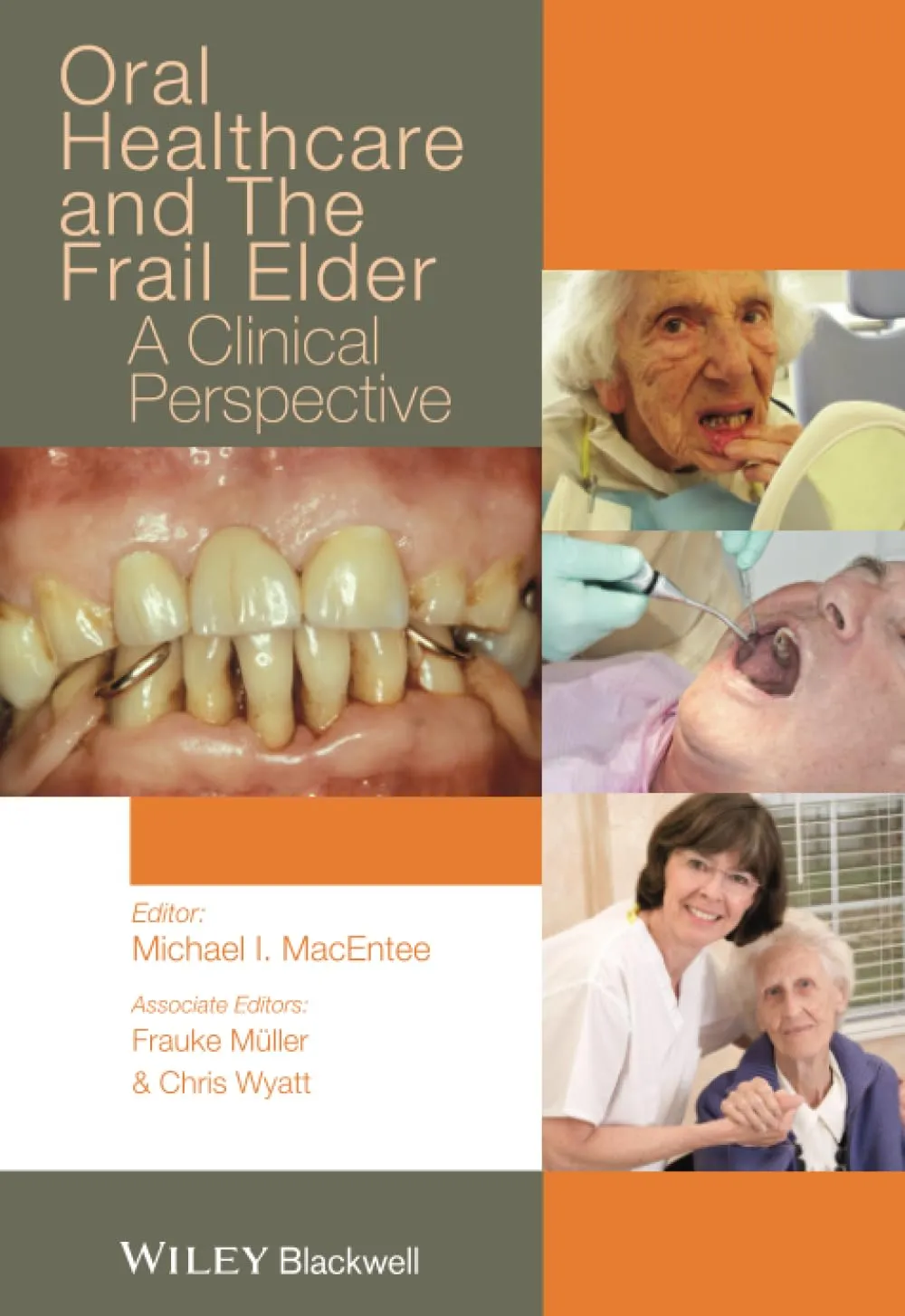 Oral Healthcare and the Frail Elder A Clinical Perspective | Paperback