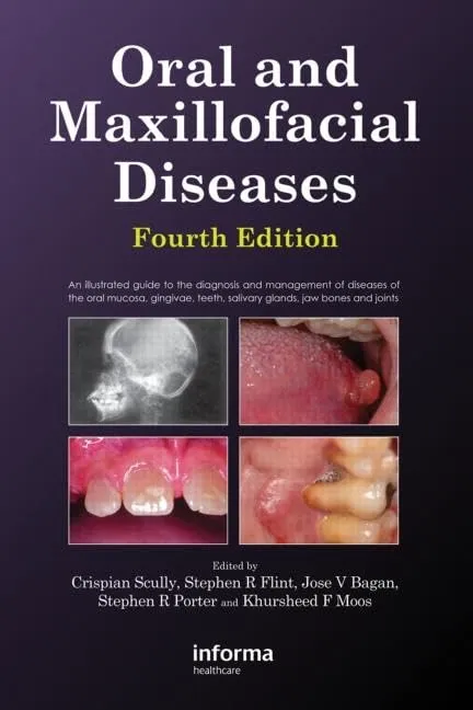 Oral and Maxillofacial Diseases | 4th Edition | Hardcover