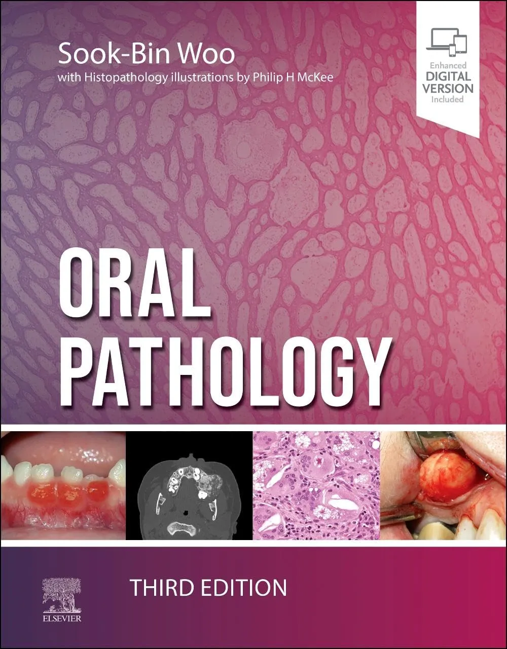 Oral Pathology With Access Code Third Edition | Hardcover