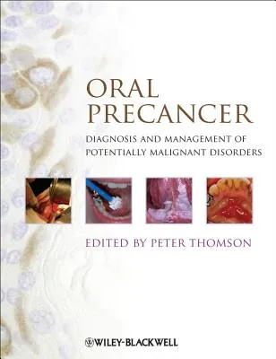 Oral Precancer Diagnosis and Management of Potentially Malignant Disorders | Hardcover