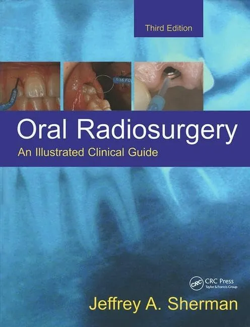 Oral Radiosurgery An Illustrated Clinical Guide | Third Edition | Hardcover
